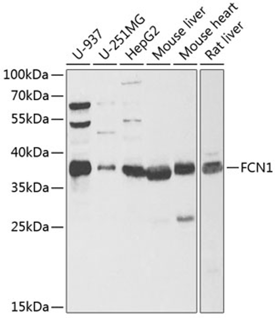 Western blot analysis of extracts of various cell lines, using FCN1 antibody (22-334) at 1:1000 dilution._Secondary antibody: HRP Goat Anti-Rabbit IgG (H+L) at 1:10000 dilution._Lysates/proteins: 25ug per lane._Blocking buffer: 3% nonfat dry milk in TBST._Detection: ECL Enhanced Kit._Exposure time: 90s.