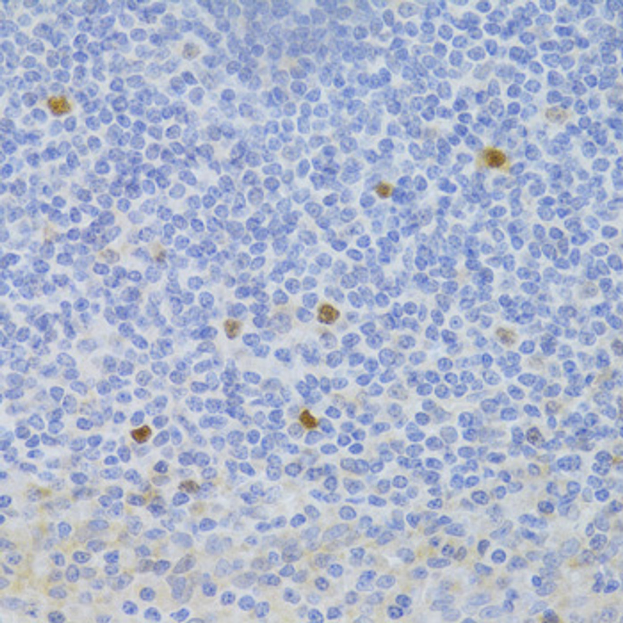 Immunohistochemistry of paraffin-embedded human tonsil using FCN1 Antibody (22-334) at dilution of 1:100 (40x lens) .