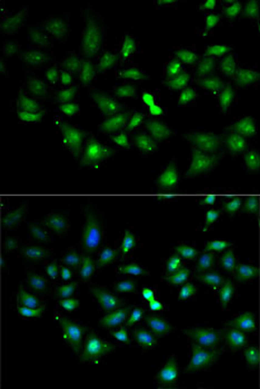 Immunofluorescence analysis of MCF7 cells using FLOT2 antibody (22-336) . Blue: DAPI for nuclear staining.