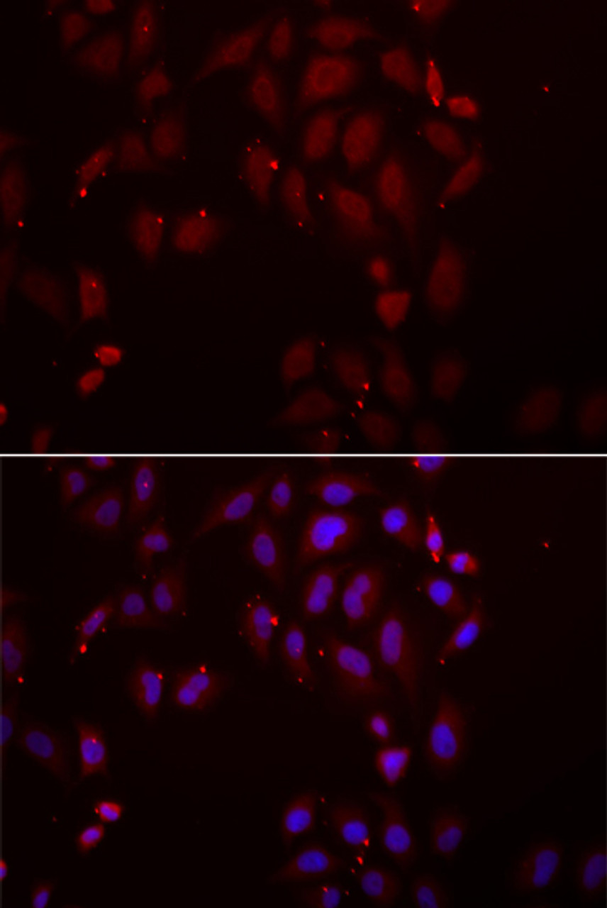Immunofluorescence analysis of A549 cells using FRZB antibody (22-337) . Blue: DAPI for nuclear staining.
