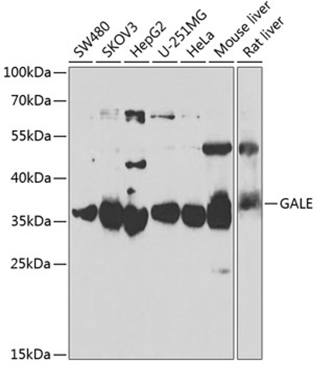 Western blot analysis of extracts of various cell lines, using GALE antibody (22-339) at 1:1000 dilution.<br/>Secondary antibody: HRP Goat Anti-Rabbit IgG (H+L) at 1:10000 dilution.<br/>Lysates/proteins: 25ug per lane.<br/>Blocking buffer: 3% nonfat dry milk in TBST.<br/>Detection: ECL Basic Kit.<br/>Exposure time: 3s.