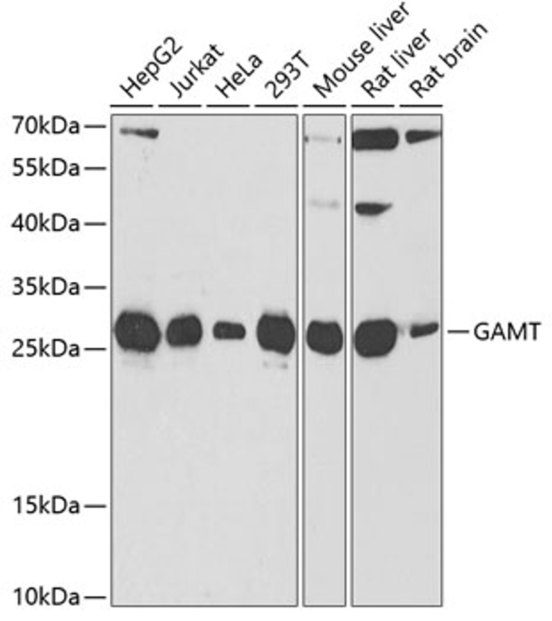 Western blot analysis of extracts of various cell lines, using GAMT antibody (22-340) at 1:1000 dilution.<br/>Secondary antibody: HRP Goat Anti-Rabbit IgG (H+L) at 1:10000 dilution.<br/>Lysates/proteins: 25ug per lane.<br/>Blocking buffer: 3% nonfat dry milk in TBST.<br/>Detection: ECL Basic Kit.<br/>Exposure time: 90s.