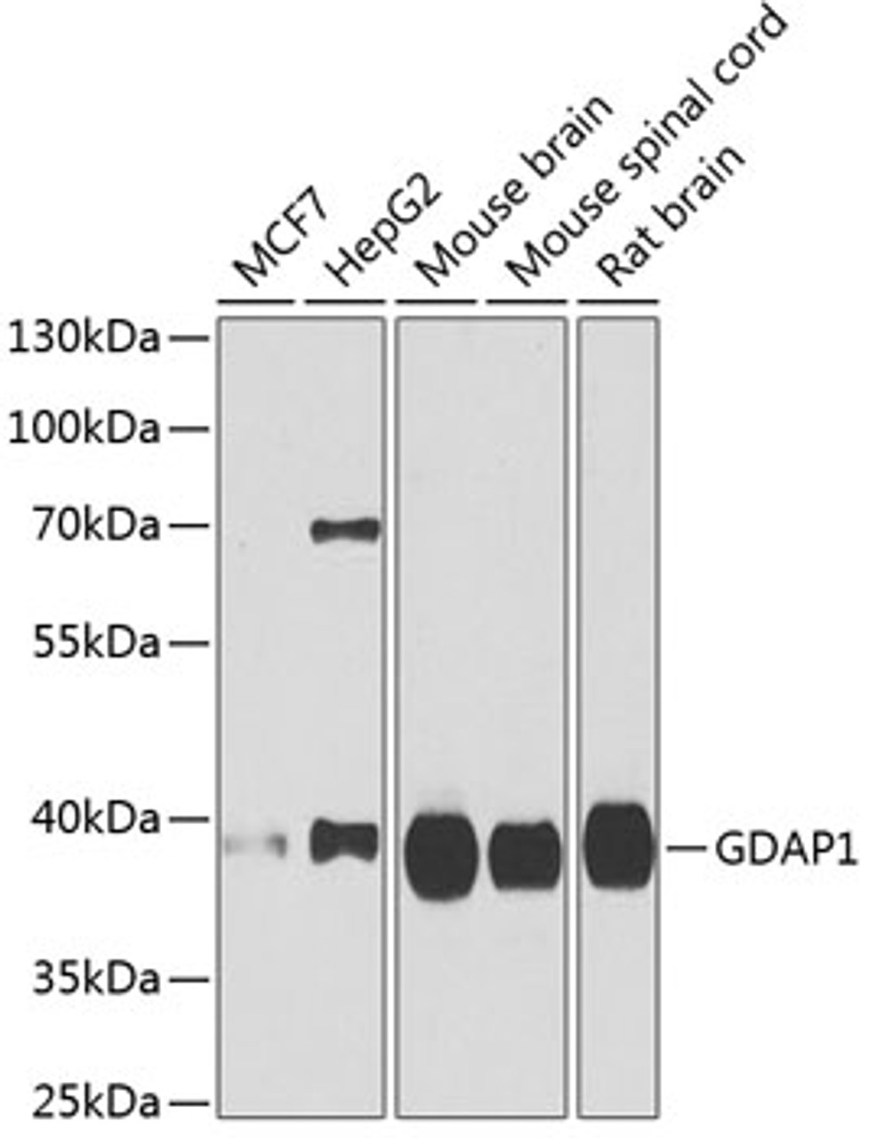 Western blot analysis of extracts of various cell lines, using GDAP1 antibody (22-343) at 1:1000 dilution.<br/>Secondary antibody: HRP Goat Anti-Rabbit IgG (H+L) at 1:10000 dilution.<br/>Lysates/proteins: 25ug per lane.<br/>Blocking buffer: 3% nonfat dry milk in TBST.<br/>Detection: ECL Basic Kit.<br/>Exposure time: 90s.
