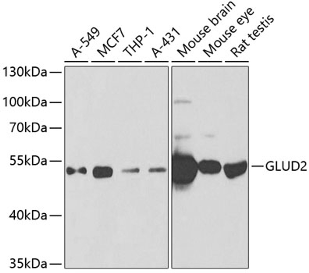 Western blot analysis of extracts of various cell lines, using GLUD2 antibody (22-344) at 1:1000 dilution.<br/>Secondary antibody: HRP Goat Anti-Rabbit IgG (H+L) at 1:10000 dilution.<br/>Lysates/proteins: 25ug per lane.<br/>Blocking buffer: 3% nonfat dry milk in TBST.<br/>Detection: ECL Basic Kit.<br/>Exposure time: 90s.