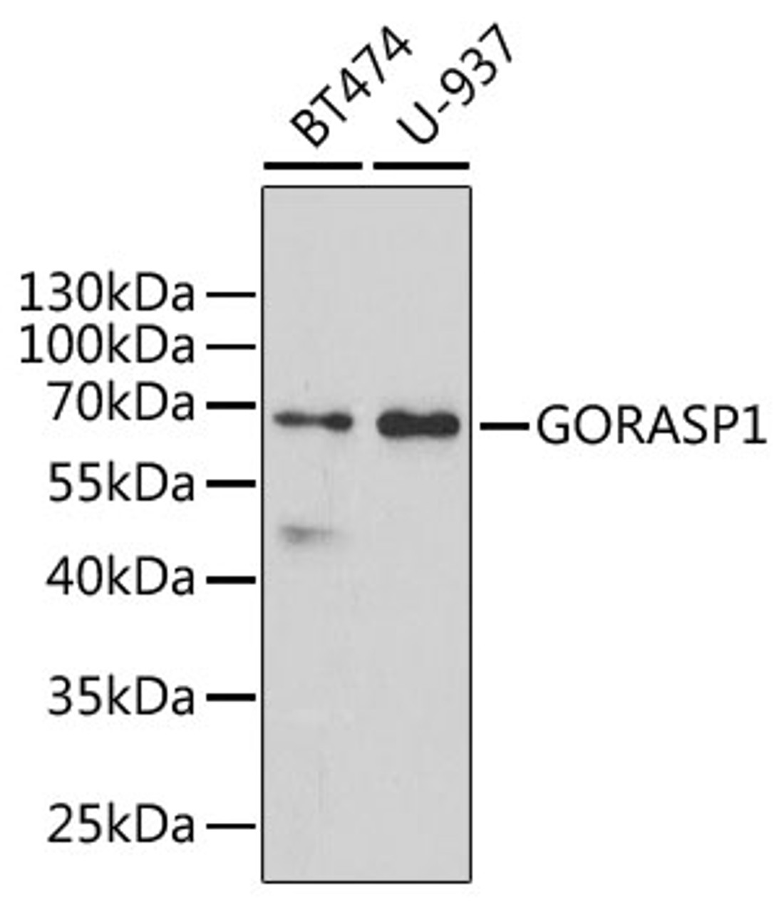 Western blot analysis of extracts of various cell lines, using GORASP1 antibody (22-347) at 1:1000 dilution.<br/>Secondary antibody: HRP Goat Anti-Rabbit IgG (H+L) at 1:10000 dilution.<br/>Lysates/proteins: 25ug per lane.<br/>Blocking buffer: 3% nonfat dry milk in TBST.<br/>Detection: ECL Basic Kit.<br/>Exposure time: 90s.
