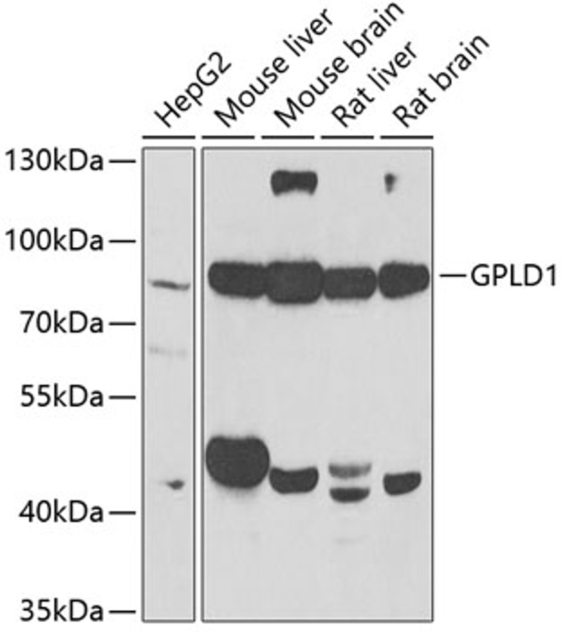 Western blot analysis of extracts of various cell lines, using GPLD1 antibody (22-350) at 1:1000 dilution.<br/>Secondary antibody: HRP Goat Anti-Rabbit IgG (H+L) at 1:10000 dilution.<br/>Lysates/proteins: 25ug per lane.<br/>Blocking buffer: 3% nonfat dry milk in TBST.<br/>Detection: ECL Basic Kit.<br/>Exposure time: 90s.