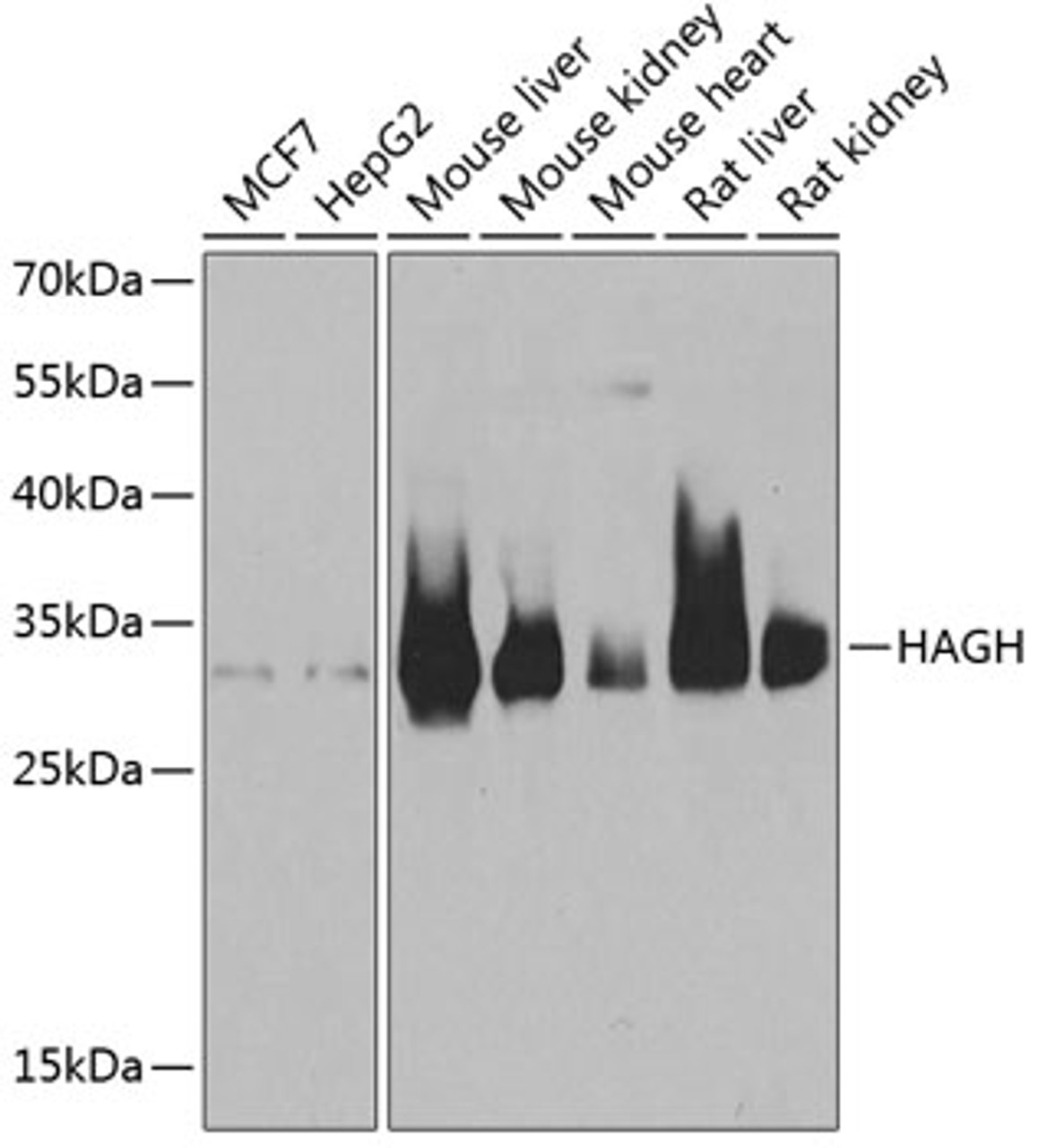 Western blot analysis of extracts of various cell lines, using HAGH antibody (22-353) at 1:1000 dilution.<br/>Secondary antibody: HRP Goat Anti-Rabbit IgG (H+L) at 1:10000 dilution.<br/>Lysates/proteins: 25ug per lane.<br/>Blocking buffer: 3% nonfat dry milk in TBST.<br/>Detection: ECL Basic Kit.<br/>Exposure time: 1s.