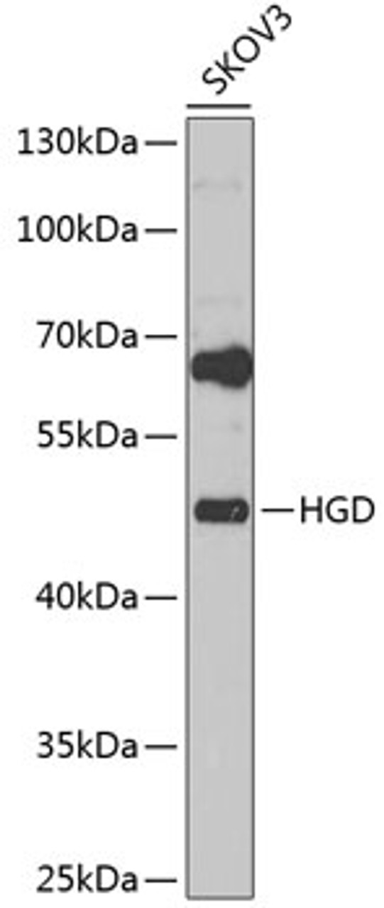 Western blot analysis of extracts of SKOV3 cells, using HGD Antibody (22-356) at 1:1000 dilution.<br/>Secondary antibody: HRP Goat Anti-Rabbit IgG (H+L) at 1:10000 dilution.<br/>Lysates/proteins: 25ug per lane.<br/>Blocking buffer: 3% nonfat dry milk in TBST.<br/>Detection: ECL Basic Kit.<br/>Exposure time: 20s.