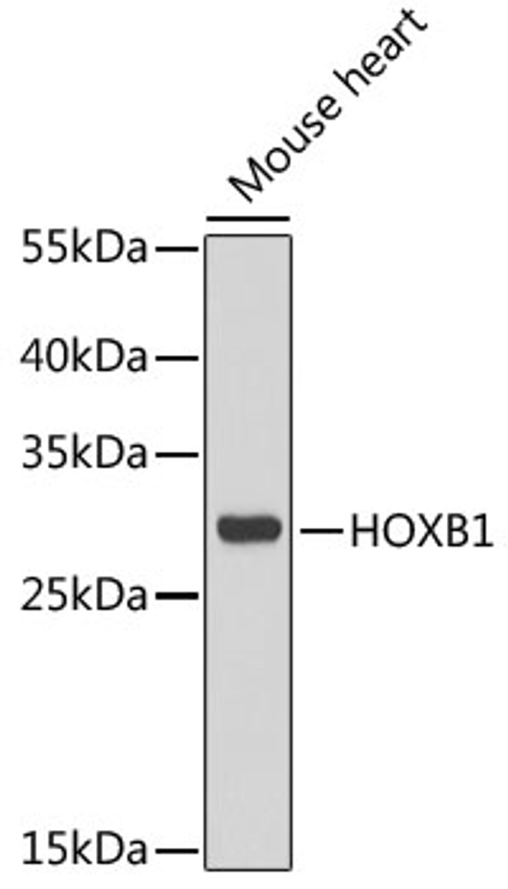 Western blot analysis of extracts of mouse heart, using HOXB1 antibody (22-357) at 1:1000 dilution.<br/>Secondary antibody: HRP Goat Anti-Rabbit IgG (H+L) at 1:10000 dilution.<br/>Lysates/proteins: 25ug per lane.<br/>Blocking buffer: 3% nonfat dry milk in TBST.<br/>Detection: ECL Basic Kit.<br/>Exposure time: 30s.