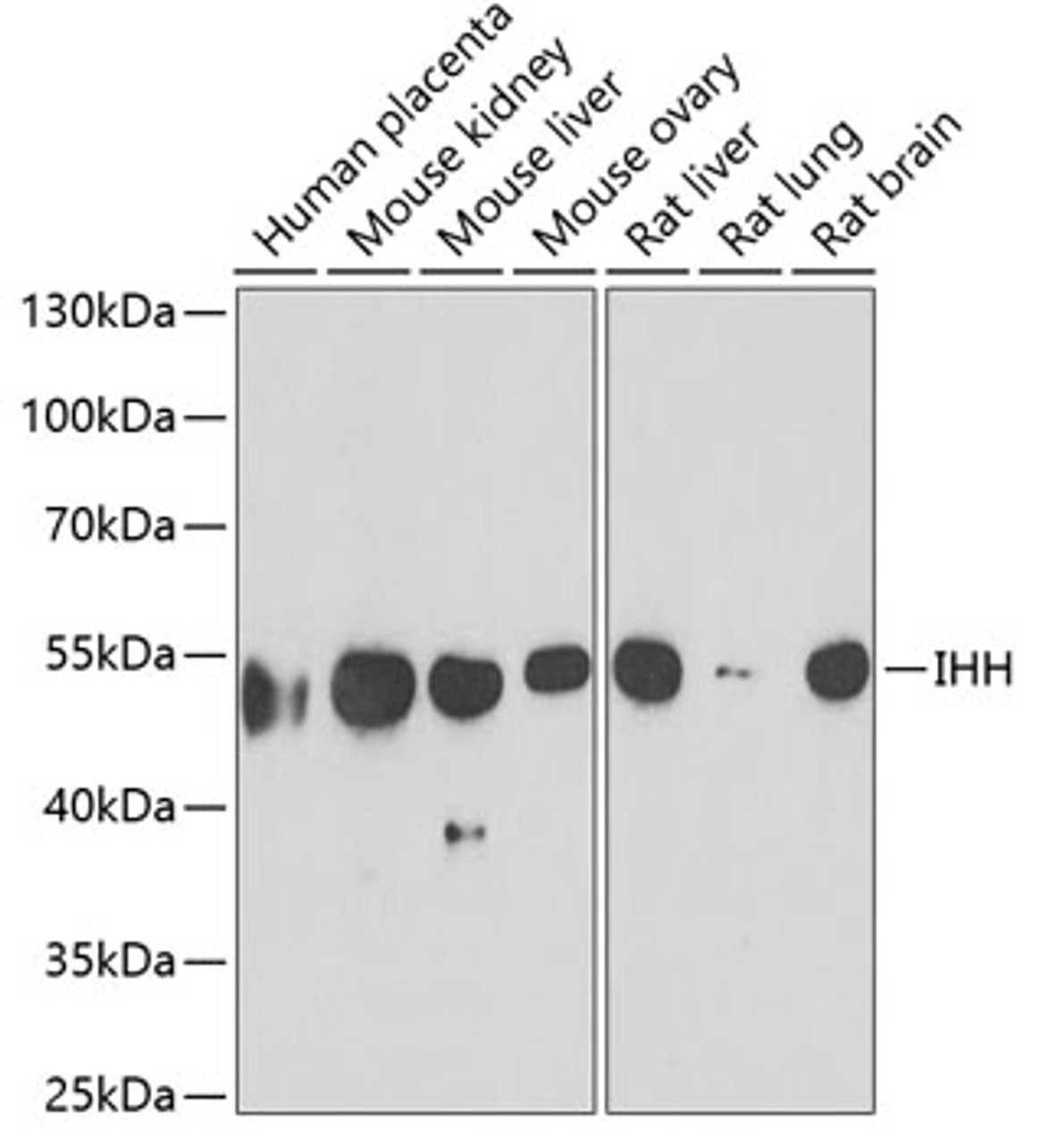 Western blot analysis of extracts of various cell lines, using IHH antibody (22-361) at 1:1000 dilution.<br/>Secondary antibody: HRP Goat Anti-Rabbit IgG (H+L) at 1:10000 dilution.<br/>Lysates/proteins: 25ug per lane.<br/>Blocking buffer: 3% nonfat dry milk in TBST.<br/>Detection: ECL Basic Kit.<br/>Exposure time: 90s.
