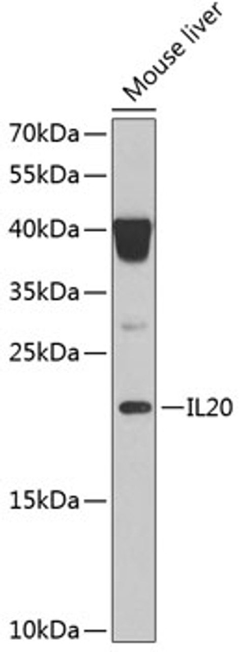 Western blot analysis of extracts of mouse liver, using IL20 Antibody (22-363) at 1:1000 dilution.<br/>Secondary antibody: HRP Goat Anti-Rabbit IgG (H+L) at 1:10000 dilution.<br/>Lysates/proteins: 25ug per lane.<br/>Blocking buffer: 3% nonfat dry milk in TBST.<br/>Detection: ECL Basic Kit.<br/>Exposure time: 90s.