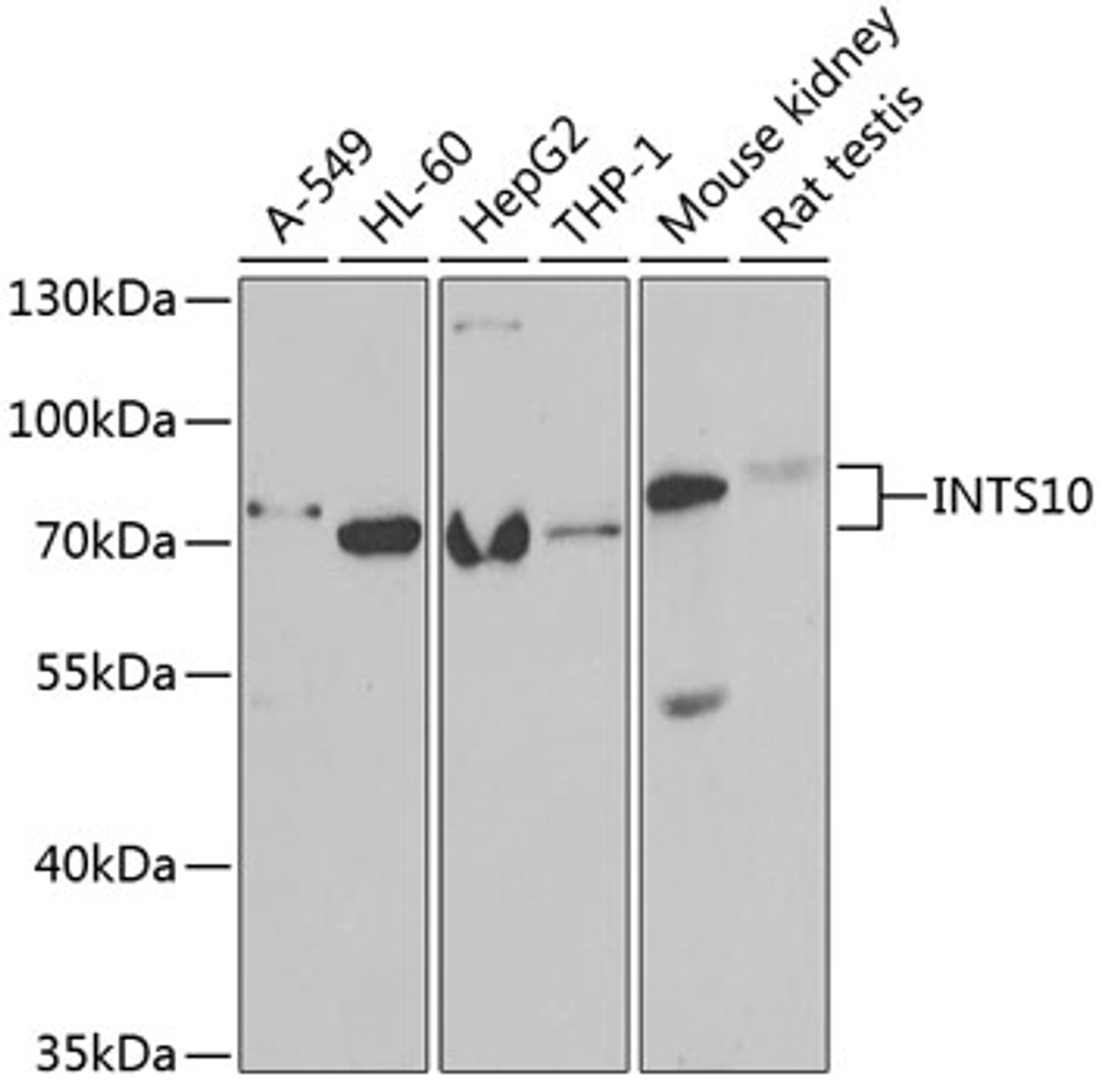 Western blot analysis of extracts of various cell lines, using INTS10 antibody (22-366) at 1:1000 dilution.<br/>Secondary antibody: HRP Goat Anti-Rabbit IgG (H+L) at 1:10000 dilution.<br/>Lysates/proteins: 25ug per lane.<br/>Blocking buffer: 3% nonfat dry milk in TBST.<br/>Detection: ECL Basic Kit.<br/>Exposure time: 90s.