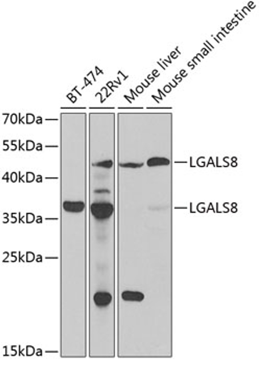 Western blot analysis of extracts of various cell lines, using LGALS8 antibody (22-376) at 1:1000 dilution.<br/>Secondary antibody: HRP Goat Anti-Rabbit IgG (H+L) at 1:10000 dilution.<br/>Lysates/proteins: 25ug per lane.<br/>Blocking buffer: 3% nonfat dry milk in TBST.<br/>Detection: ECL Basic Kit.<br/>Exposure time: 90s.