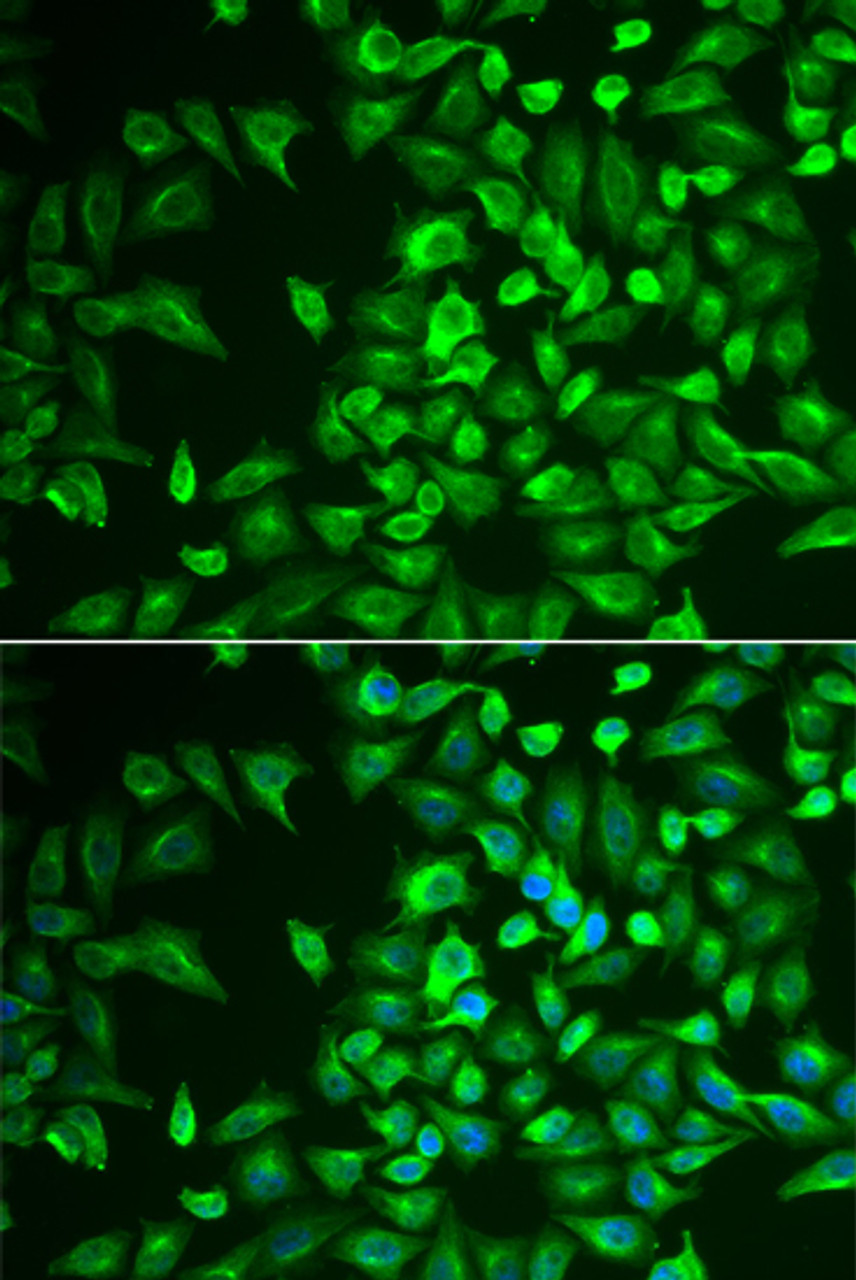 Immunofluorescence analysis of U2OS cells using LRAT antibody (22-377) . Blue: DAPI for nuclear staining.