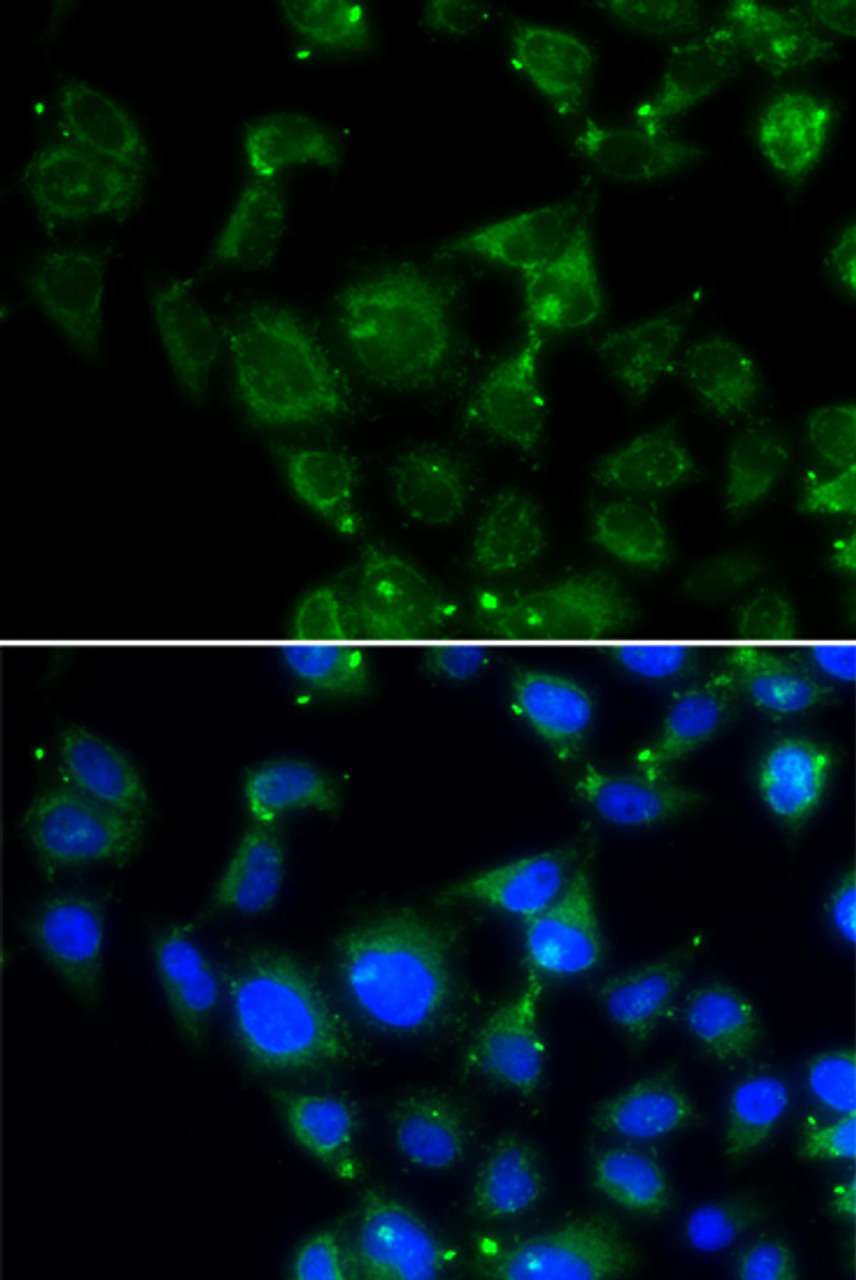 Immunofluorescence analysis of HeLa cells using MAPRE2 antibody (22-378) . Blue: DAPI for nuclear staining.