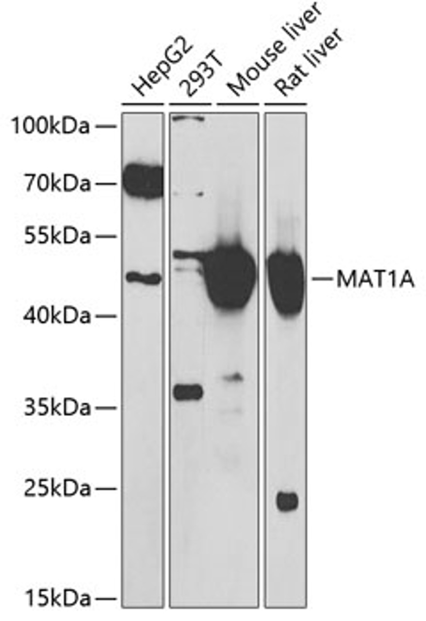 Western blot analysis of extracts of various cell lines, using MAT1A antibody (22-379) at 1:1000 dilution.<br/>Secondary antibody: HRP Goat Anti-Rabbit IgG (H+L) at 1:10000 dilution.<br/>Lysates/proteins: 25ug per lane.<br/>Blocking buffer: 3% nonfat dry milk in TBST.<br/>Detection: ECL Basic Kit.<br/>Exposure time: 90s.