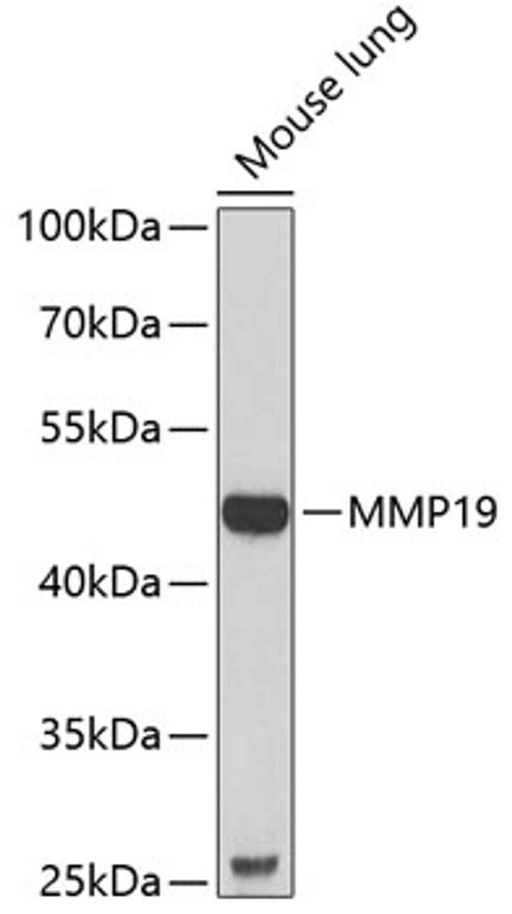 Western blot analysis of extracts of mouse lung, using MMP19 antibody (22-383) at 1:1000 dilution.<br/>Secondary antibody: HRP Goat Anti-Rabbit IgG (H+L) at 1:10000 dilution.<br/>Lysates/proteins: 25ug per lane.<br/>Blocking buffer: 3% nonfat dry milk in TBST.<br/>Detection: ECL Basic Kit.<br/>Exposure time: 90s.