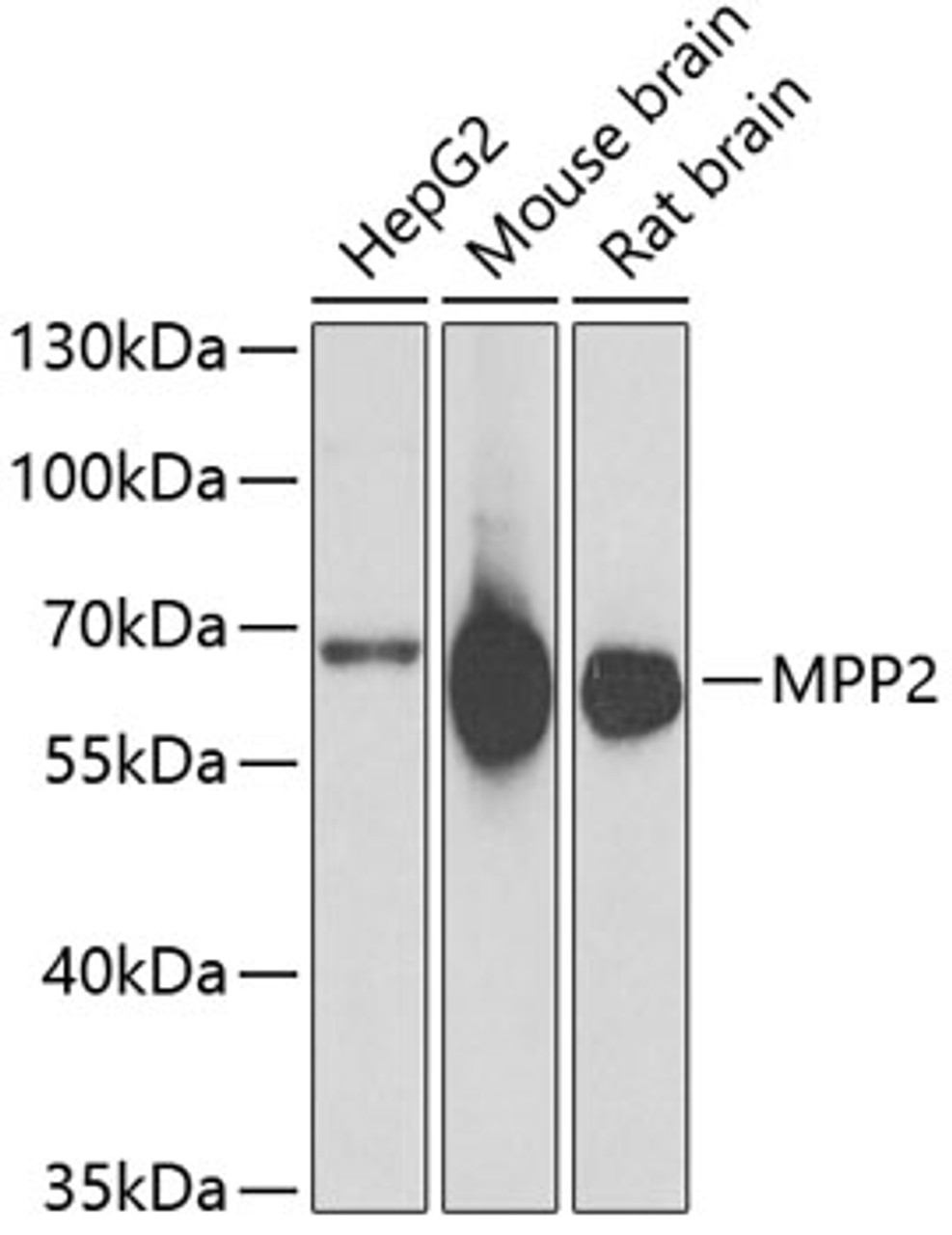 Western blot analysis of extracts of various cell lines, using MPP2 antibody (22-385) at 1:1000 dilution.<br/>Secondary antibody: HRP Goat Anti-Rabbit IgG (H+L) at 1:10000 dilution.<br/>Lysates/proteins: 25ug per lane.<br/>Blocking buffer: 3% nonfat dry milk in TBST.<br/>Detection: ECL Basic Kit.<br/>Exposure time: 30s.