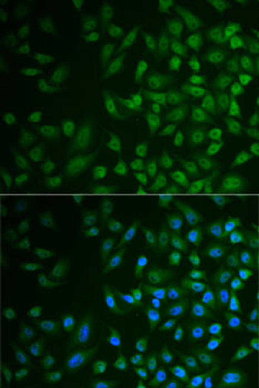 Immunofluorescence analysis of MCF7 cells using MPP2 antibody (22-385) . Blue: DAPI for nuclear staining.