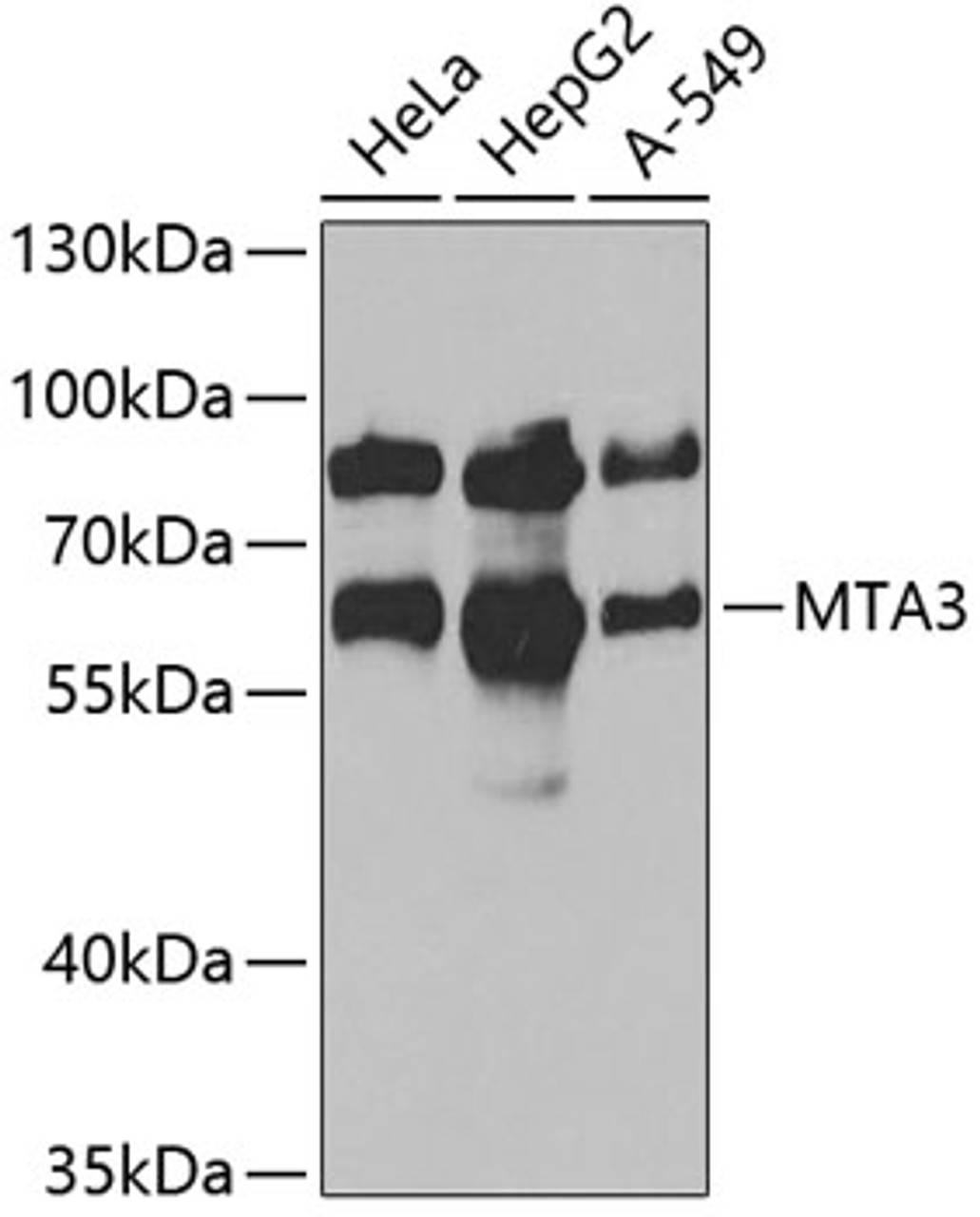 Western blot analysis of extracts of various cell lines, using MTA3 antibody (22-386) at 1:1000 dilution.<br/>Secondary antibody: HRP Goat Anti-Rabbit IgG (H+L) at 1:10000 dilution.<br/>Lysates/proteins: 25ug per lane.<br/>Blocking buffer: 3% nonfat dry milk in TBST.<br/>Detection: ECL Basic Kit.<br/>Exposure time: 30s.