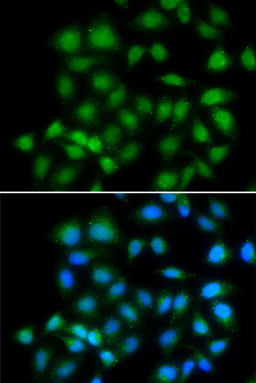Immunofluorescence analysis of HeLa cells using MXI1 antibody (22-387) . Blue: DAPI for nuclear staining.