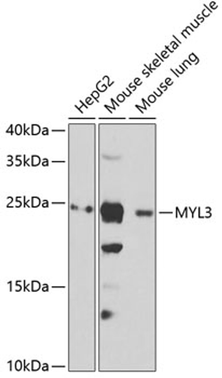 Western blot analysis of extracts of various cell lines, using MYL3 antibody (22-388) at 1:1000 dilution.<br/>Secondary antibody: HRP Goat Anti-Rabbit IgG (H+L) at 1:10000 dilution.<br/>Lysates/proteins: 25ug per lane.<br/>Blocking buffer: 3% nonfat dry milk in TBST.<br/>Detection: ECL Basic Kit.<br/>Exposure time: 15s.