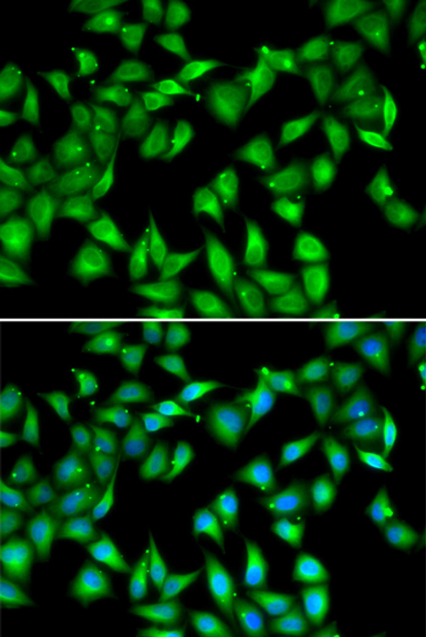 Immunofluorescence analysis of U2OS cells using MYL3 antibody (22-388) . Blue: DAPI for nuclear staining.