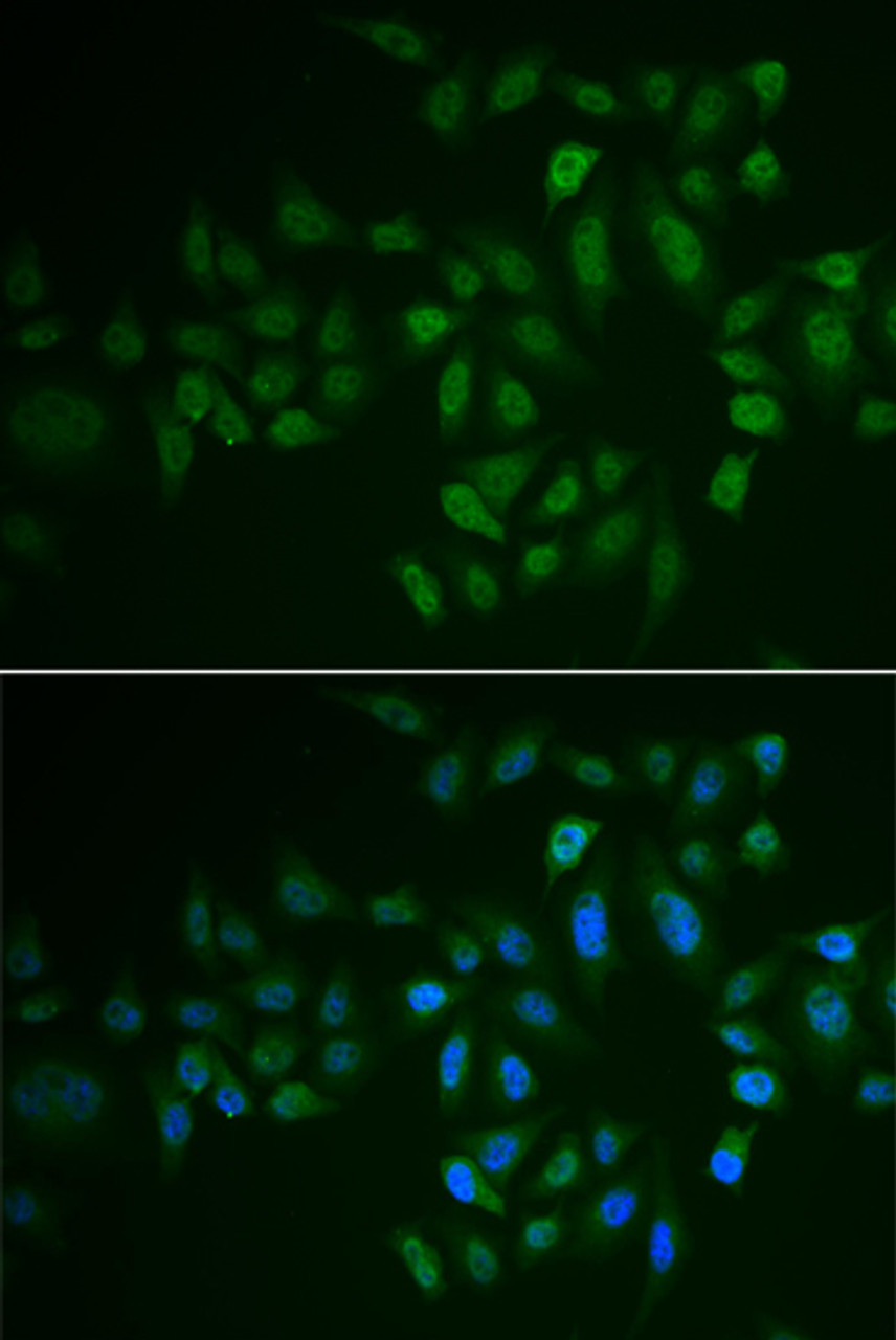 Immunofluorescence analysis of U2OS cells using MYLK3 antibody (22-389) . Blue: DAPI for nuclear staining.