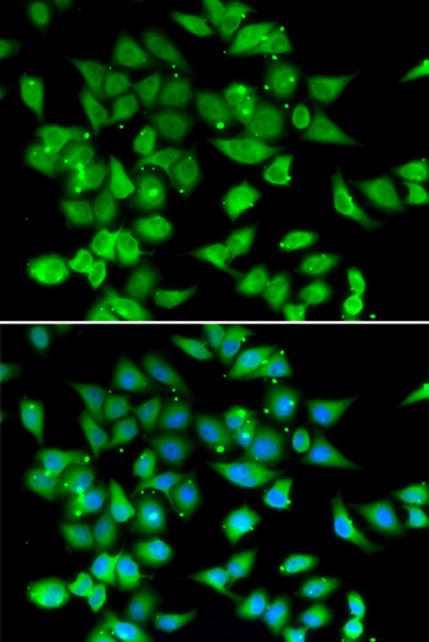 Immunofluorescence analysis of HeLa cells using NFATC3 antibody (22-392) . Blue: DAPI for nuclear staining.