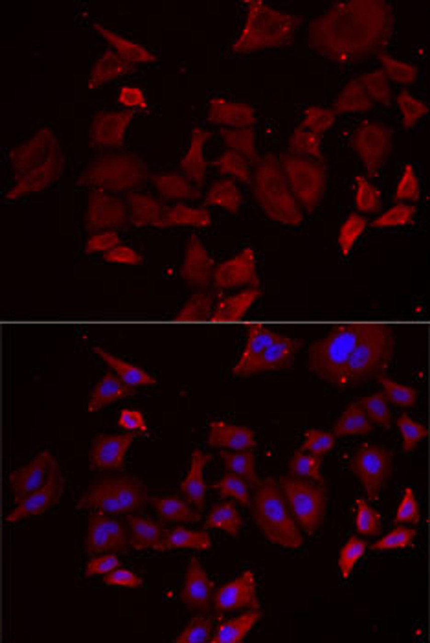 Immunofluorescence analysis of MCF7 cells using NPHP1 antibody (22-397) . Blue: DAPI for nuclear staining.
