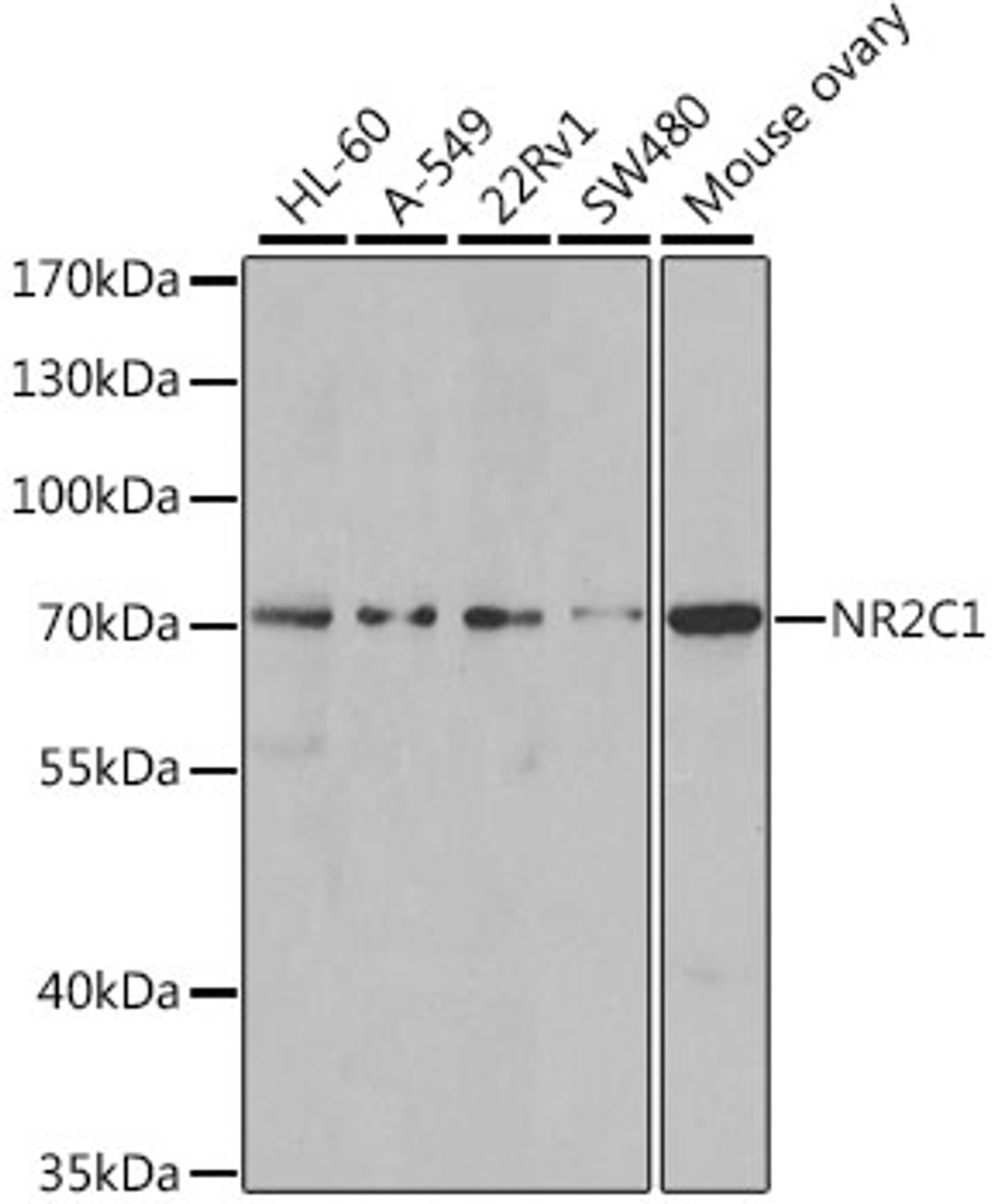 Western blot analysis of extracts of various cell lines, using NR2C1 antibody (22-398) at 1:1000 dilution.<br/>Secondary antibody: HRP Goat Anti-Rabbit IgG (H+L) at 1:10000 dilution.<br/>Lysates/proteins: 25ug per lane.<br/>Blocking buffer: 3% nonfat dry milk in TBST.<br/>Detection: ECL Basic Kit.<br/>Exposure time: 90s.