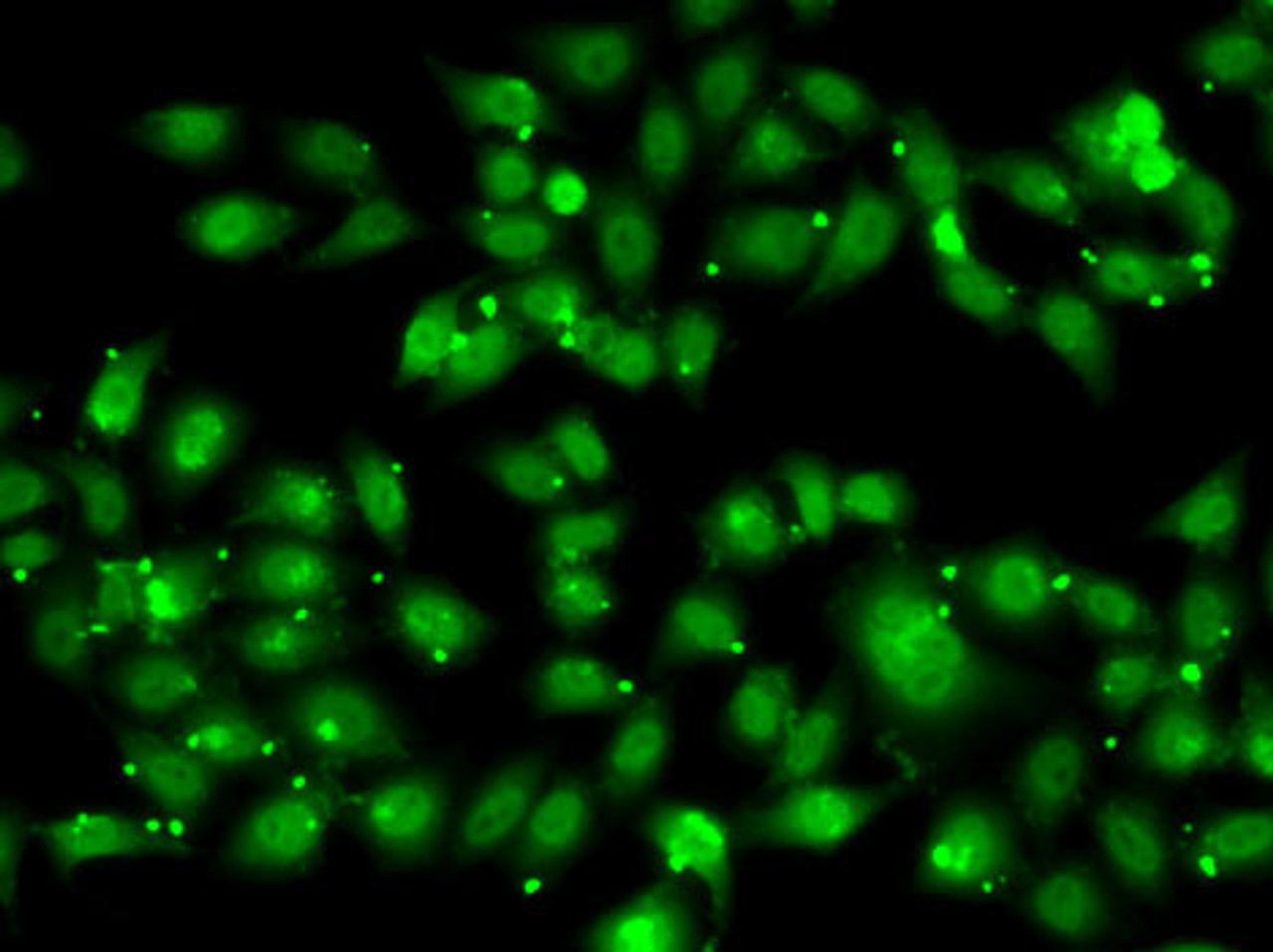 Immunofluorescence analysis of MCF7 cells using NR2C1 antibody (22-398) .