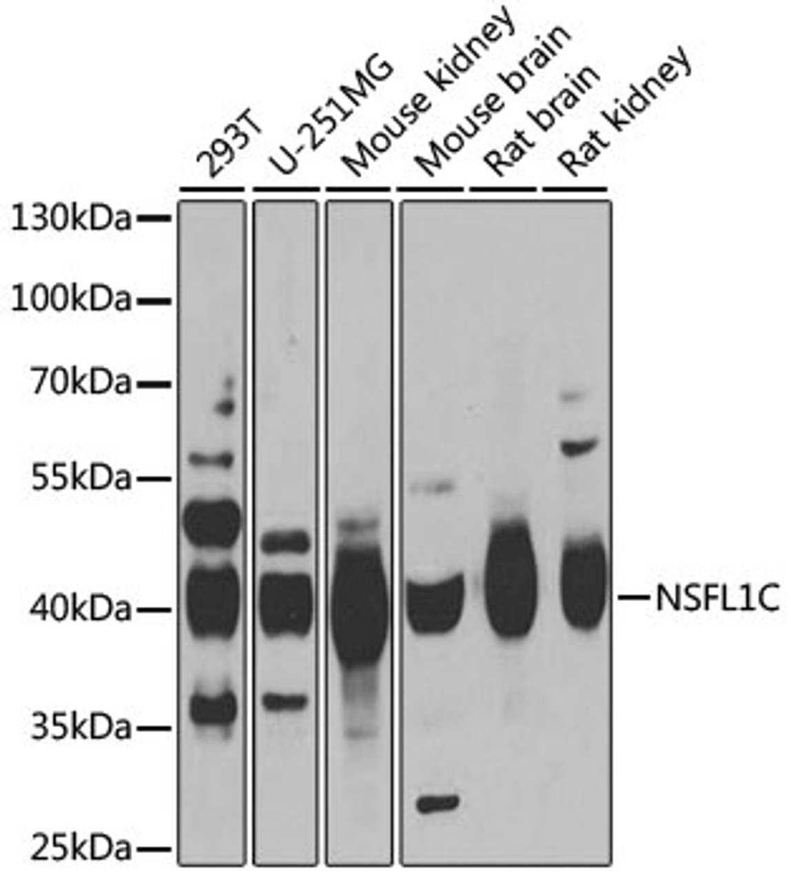 Western blot analysis of extracts of various cell lines, using NSFL1C antibody (22-399) at 1:1000 dilution.<br/>Secondary antibody: HRP Goat Anti-Rabbit IgG (H+L) at 1:10000 dilution.<br/>Lysates/proteins: 25ug per lane.<br/>Blocking buffer: 3% nonfat dry milk in TBST.<br/>Detection: ECL Basic Kit.<br/>Exposure time: 1s.