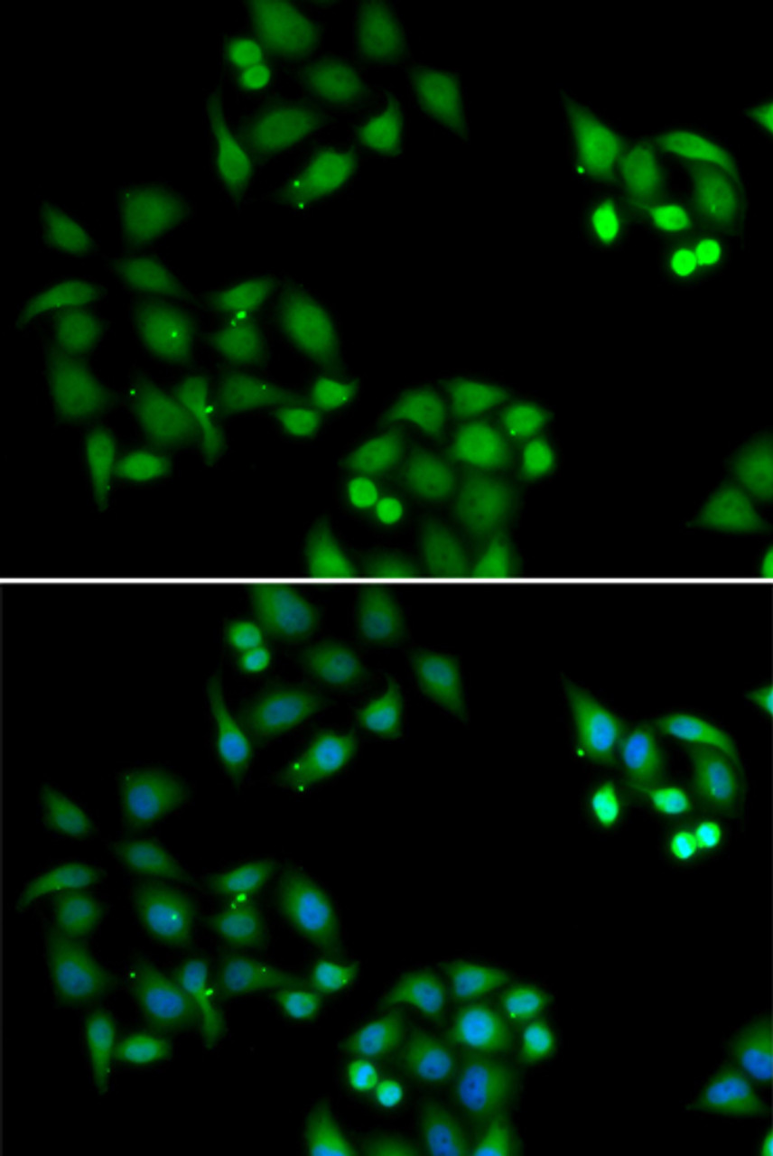 Immunofluorescence analysis of HeLa cells using NSFL1C antibody (22-399) . Blue: DAPI for nuclear staining.