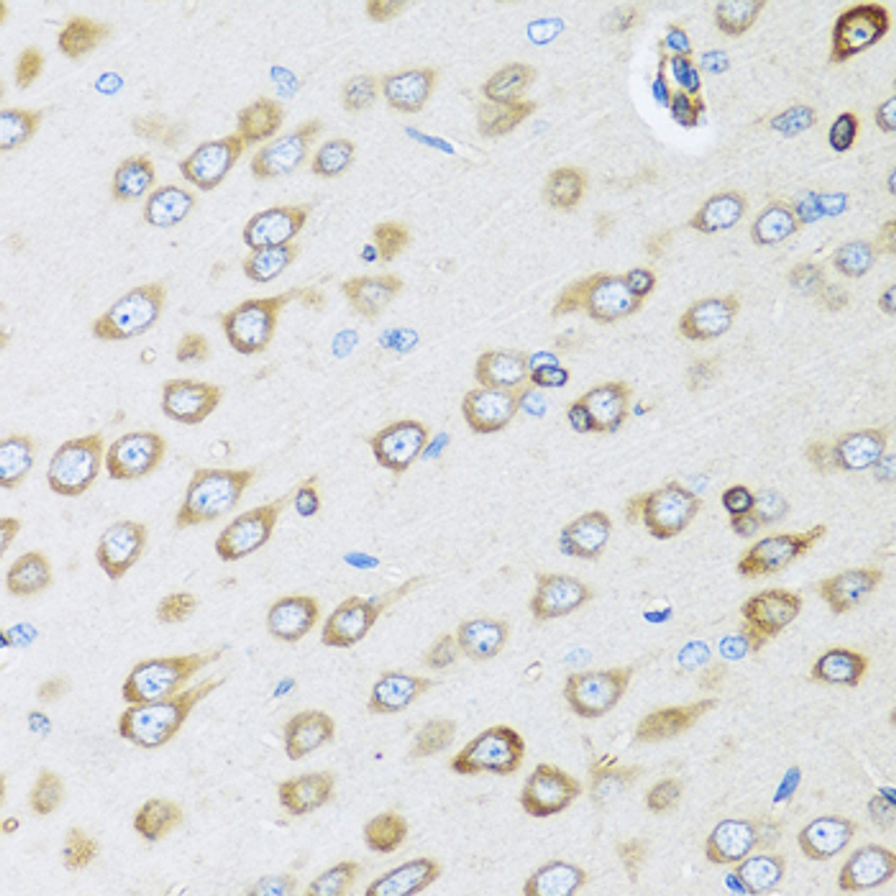 Immunohistochemistry of paraffin-embedded rat brain using OGN antibody (22-401) at dilution of 1:100 (40x lens) .