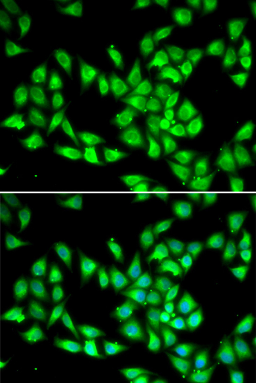 Immunofluorescence analysis of HeLa cells using PCMT1 antibody (22-403) . Blue: DAPI for nuclear staining.