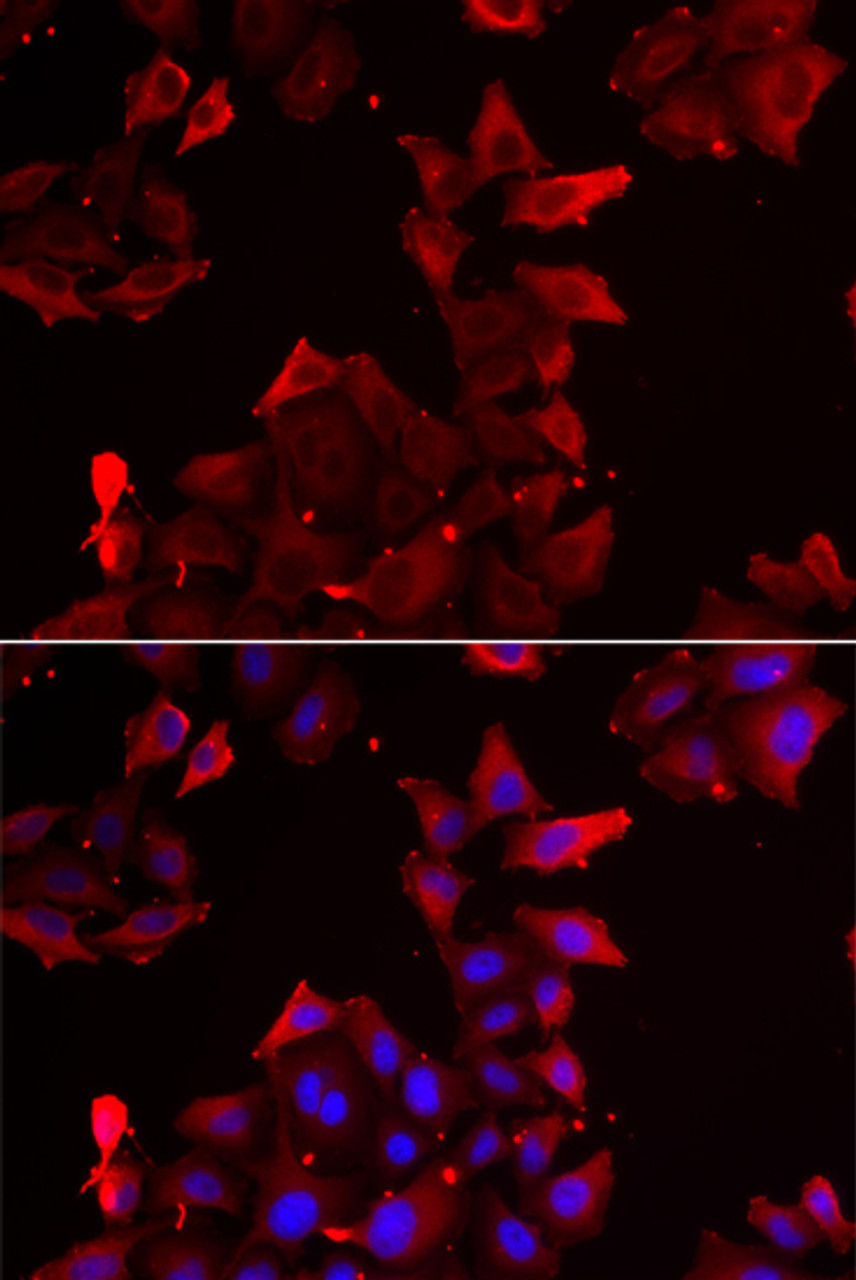 Immunofluorescence analysis of U2OS cells using PDLIM1 antibody (22-405) . Blue: DAPI for nuclear staining.