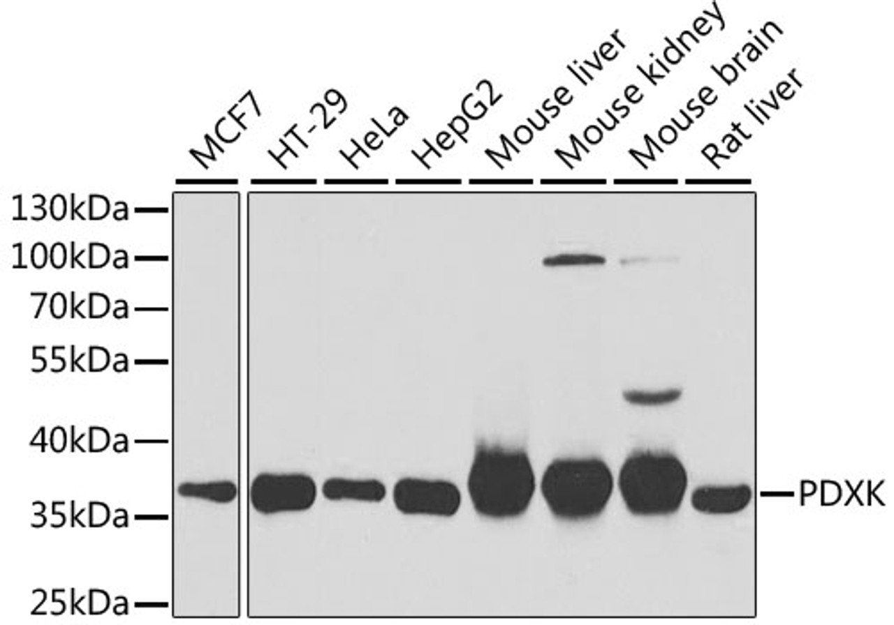 Western blot analysis of extracts of various cell lines, using PDXK antibody (22-406) at 1:1000 dilution.<br/>Secondary antibody: HRP Goat Anti-Rabbit IgG (H+L) at 1:10000 dilution.<br/>Lysates/proteins: 25ug per lane.<br/>Blocking buffer: 3% nonfat dry milk in TBST.<br/>Detection: ECL Basic Kit.<br/>Exposure time: 15s.