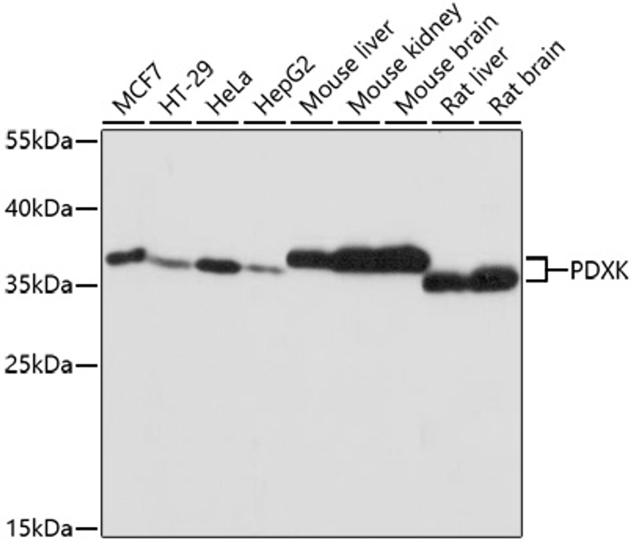 Immunofluorescence analysis of U2OS cells using PDXK antibody (22-406) . Blue: DAPI for nuclear staining.