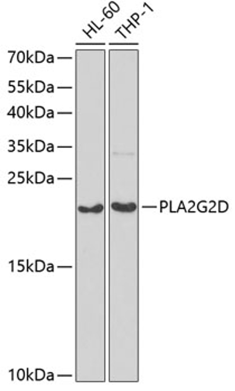 Western blot analysis of extracts of various cell lines, using PLA2G2D antibody (22-408) at 1:1000 dilution.<br/>Secondary antibody: HRP Goat Anti-Rabbit IgG (H+L) at 1:10000 dilution.<br/>Lysates/proteins: 25ug per lane.<br/>Blocking buffer: 3% nonfat dry milk in TBST.<br/>Detection: ECL Basic Kit.<br/>Exposure time: 90s.