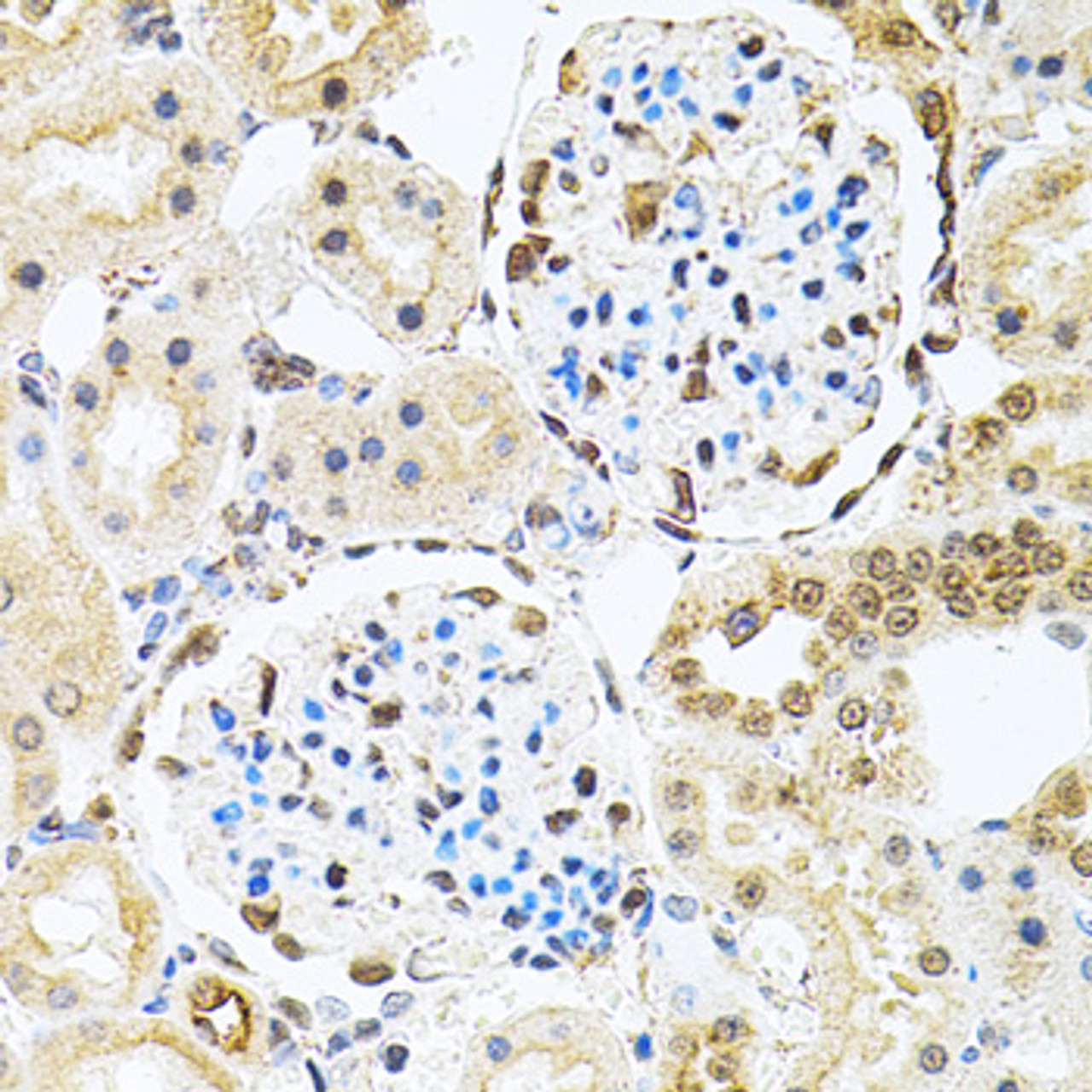 Immunohistochemistry of paraffin-embedded rat kidney using PNKP antibody (22-410) at dilution of 1:100 (40x lens) .