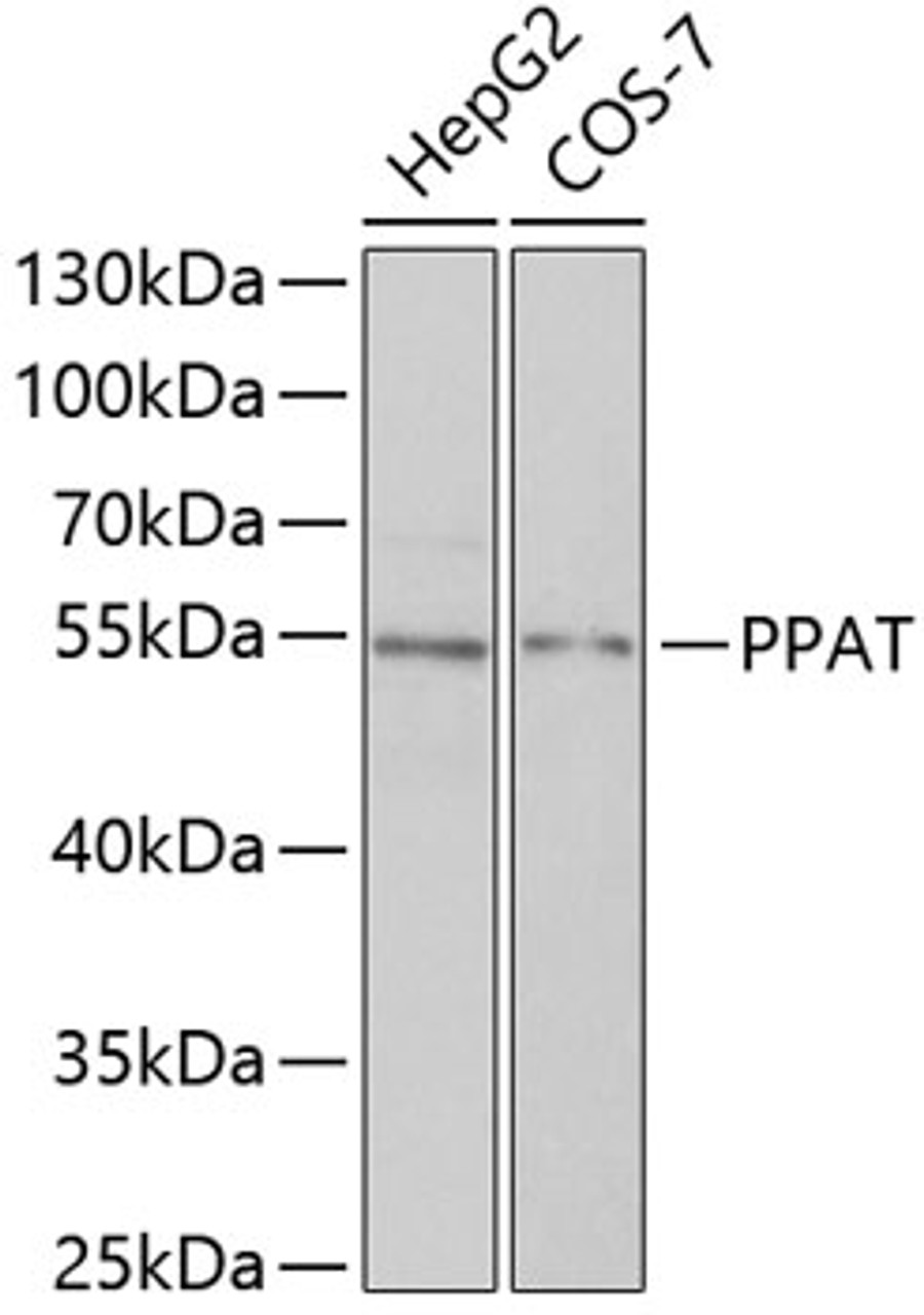 Western blot analysis of extracts of various cell lines, using PPAT antibody (22-415) at 1:1000 dilution.<br/>Secondary antibody: HRP Goat Anti-Rabbit IgG (H+L) at 1:10000 dilution.<br/>Lysates/proteins: 25ug per lane.<br/>Blocking buffer: 3% nonfat dry milk in TBST.<br/>Detection: ECL Basic Kit.<br/>Exposure time: 90s.