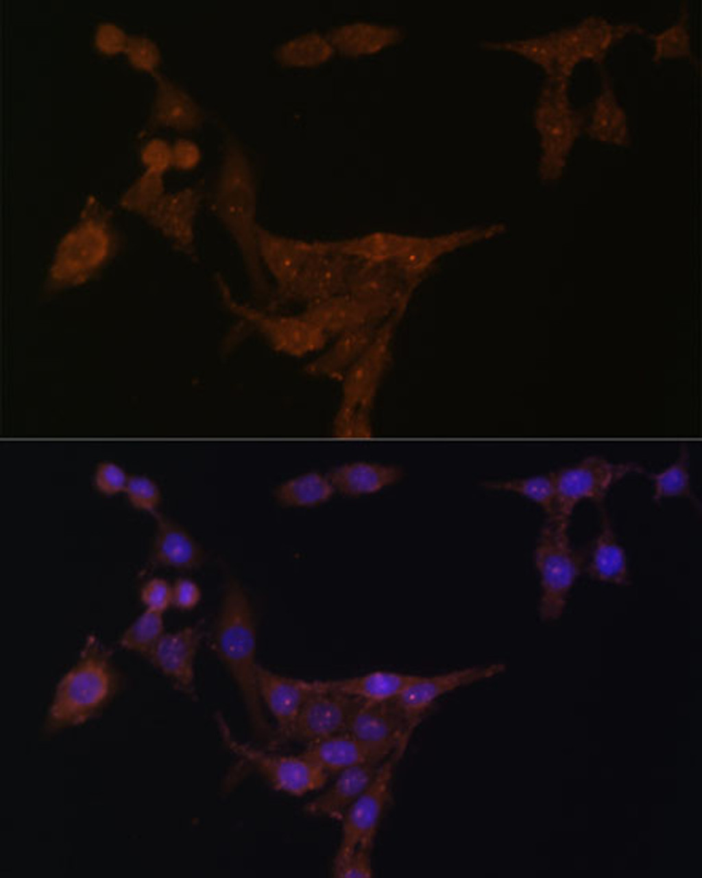 Immunofluorescence analysis of HeLa cells using PPAT Polyclonal Antibody (22-415) at dilution of 1:100 (40x lens) . Blue: DAPI for nuclear staining.
