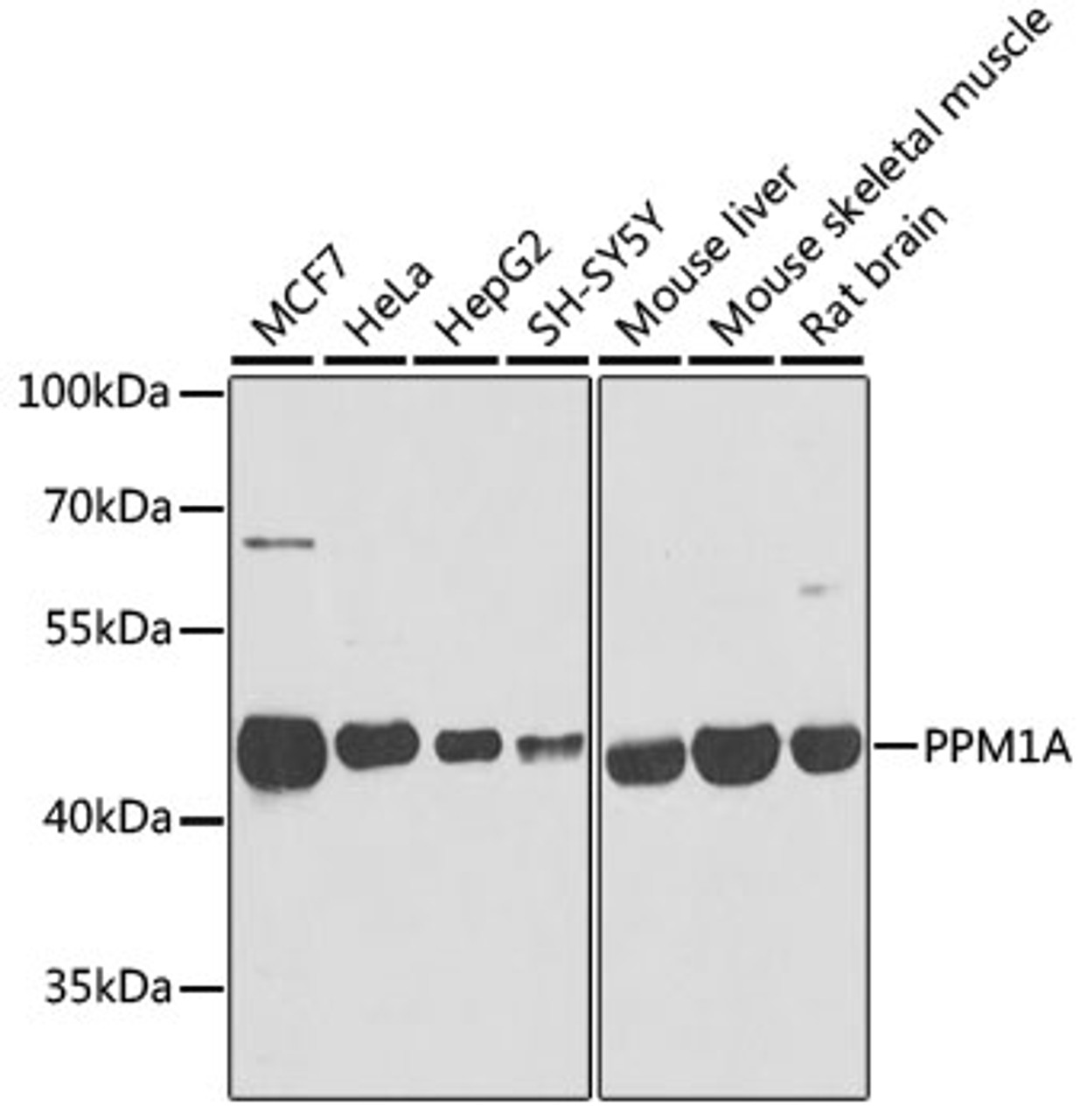 Western blot analysis of extracts of various cell lines, using PPM1A antibody (22-416) at 1:1000 dilution.<br/>Secondary antibody: HRP Goat Anti-Rabbit IgG (H+L) at 1:10000 dilution.<br/>Lysates/proteins: 25ug per lane.<br/>Blocking buffer: 3% nonfat dry milk in TBST.<br/>Detection: ECL Basic Kit.<br/>Exposure time: 1s.