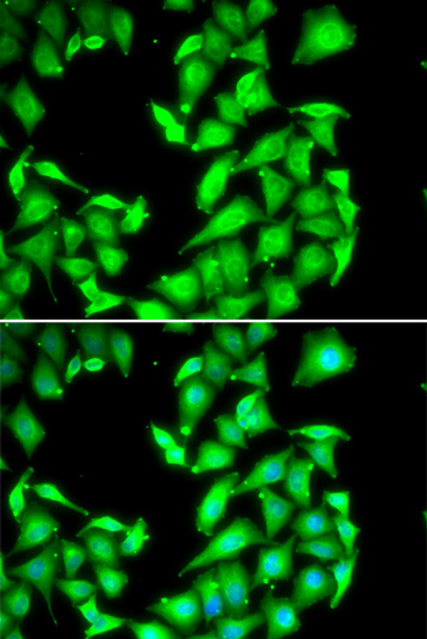 Immunofluorescence analysis of HeLa cells using PPM1A antibody (22-416) . Blue: DAPI for nuclear staining.