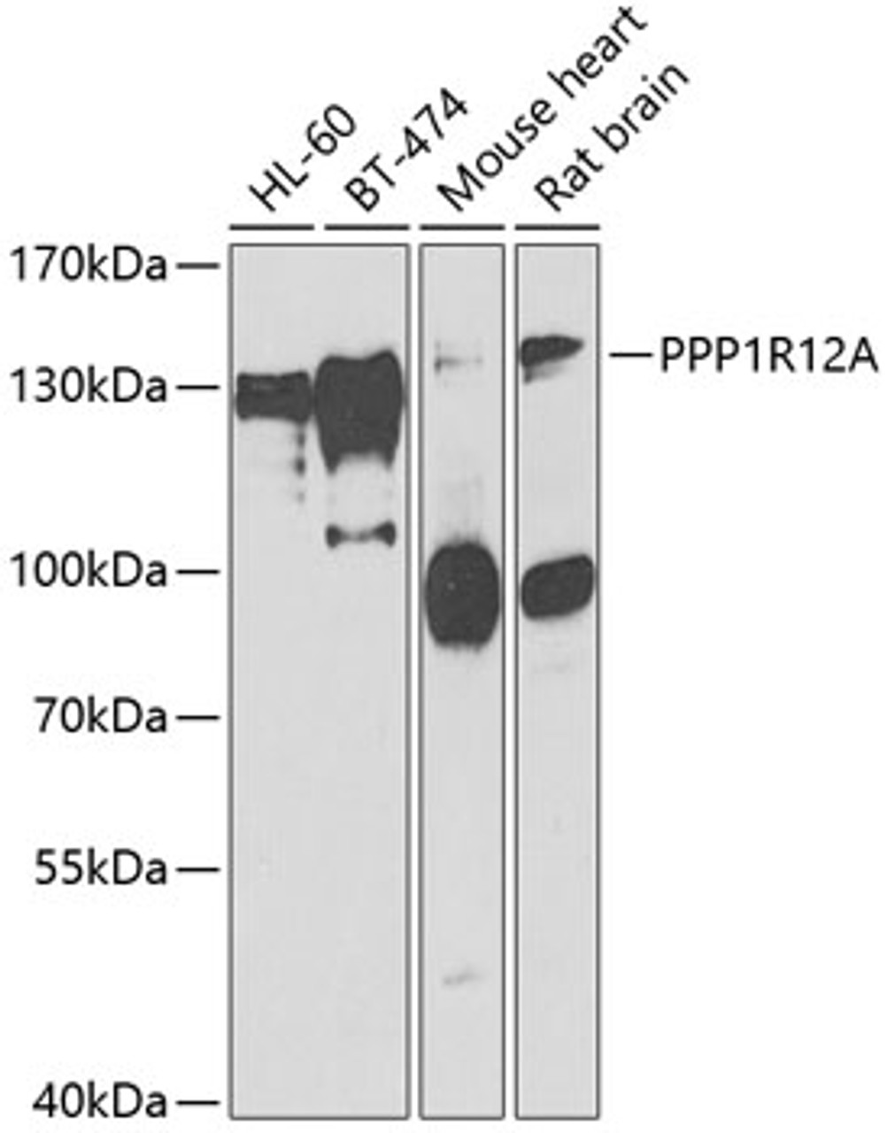 Western blot analysis of extracts of various cell lines, using PPP1R12A antibody (22-417) at 1:1000 dilution.<br/>Secondary antibody: HRP Goat Anti-Rabbit IgG (H+L) at 1:10000 dilution.<br/>Lysates/proteins: 25ug per lane.<br/>Blocking buffer: 3% nonfat dry milk in TBST.<br/>Detection: ECL Basic Kit.<br/>Exposure time: 90s.