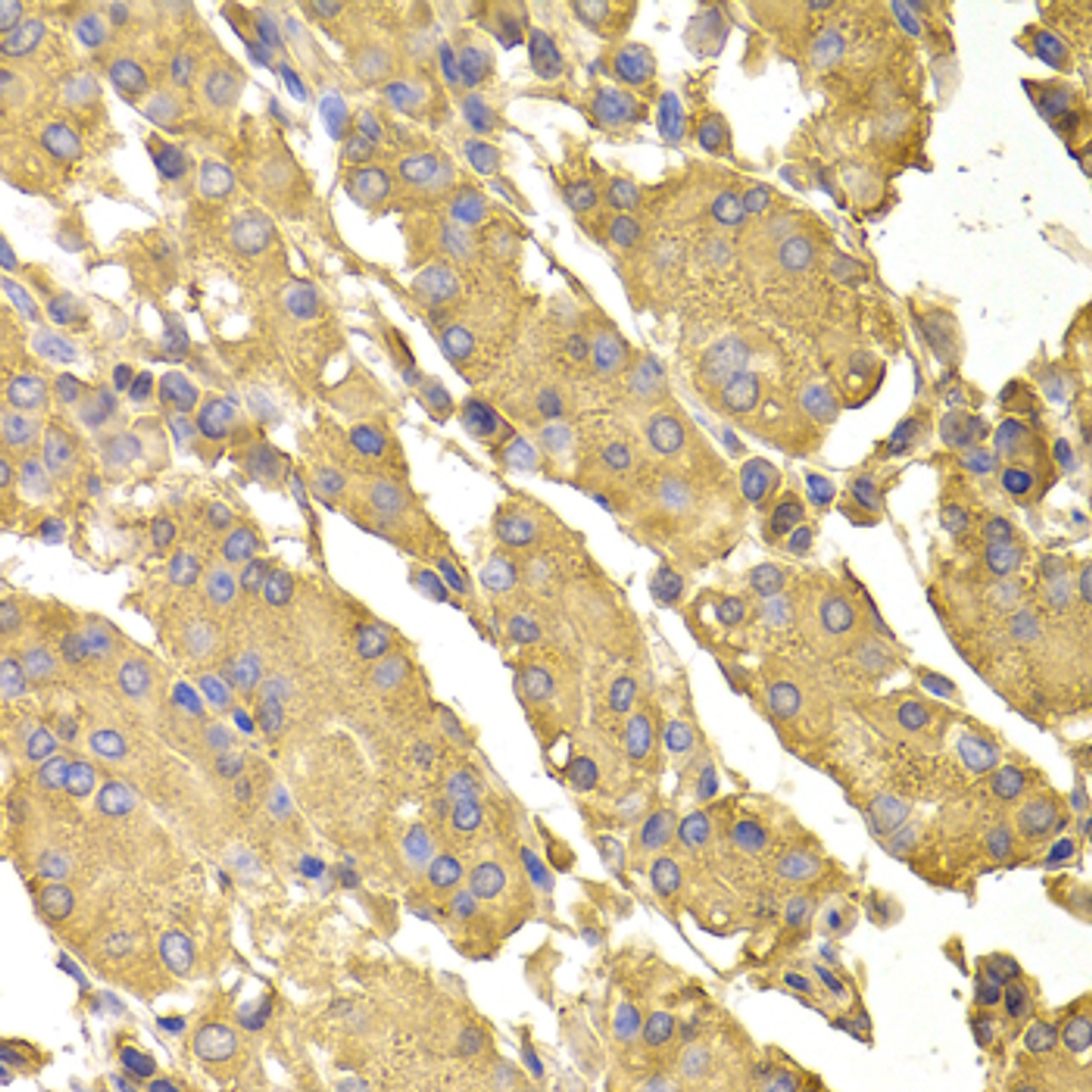 Immunohistochemistry of paraffin-embedded human stomach using PPP2CA antibody (22-419) at dilution of 1:100 (40x lens) .