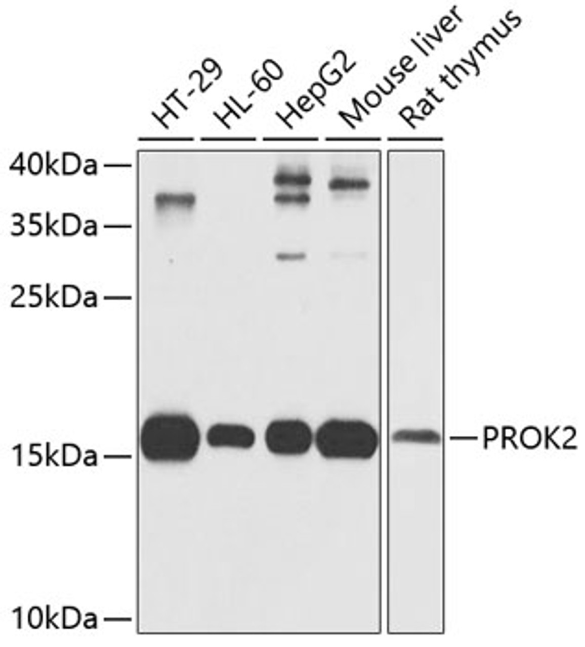 Western blot analysis of extracts of various cell lines, using PROK2 antibody (22-421) at 1:1000 dilution.<br/>Secondary antibody: HRP Goat Anti-Rabbit IgG (H+L) at 1:10000 dilution.<br/>Lysates/proteins: 25ug per lane.<br/>Blocking buffer: 3% nonfat dry milk in TBST.<br/>Detection: ECL Basic Kit.<br/>Exposure time: 30s.