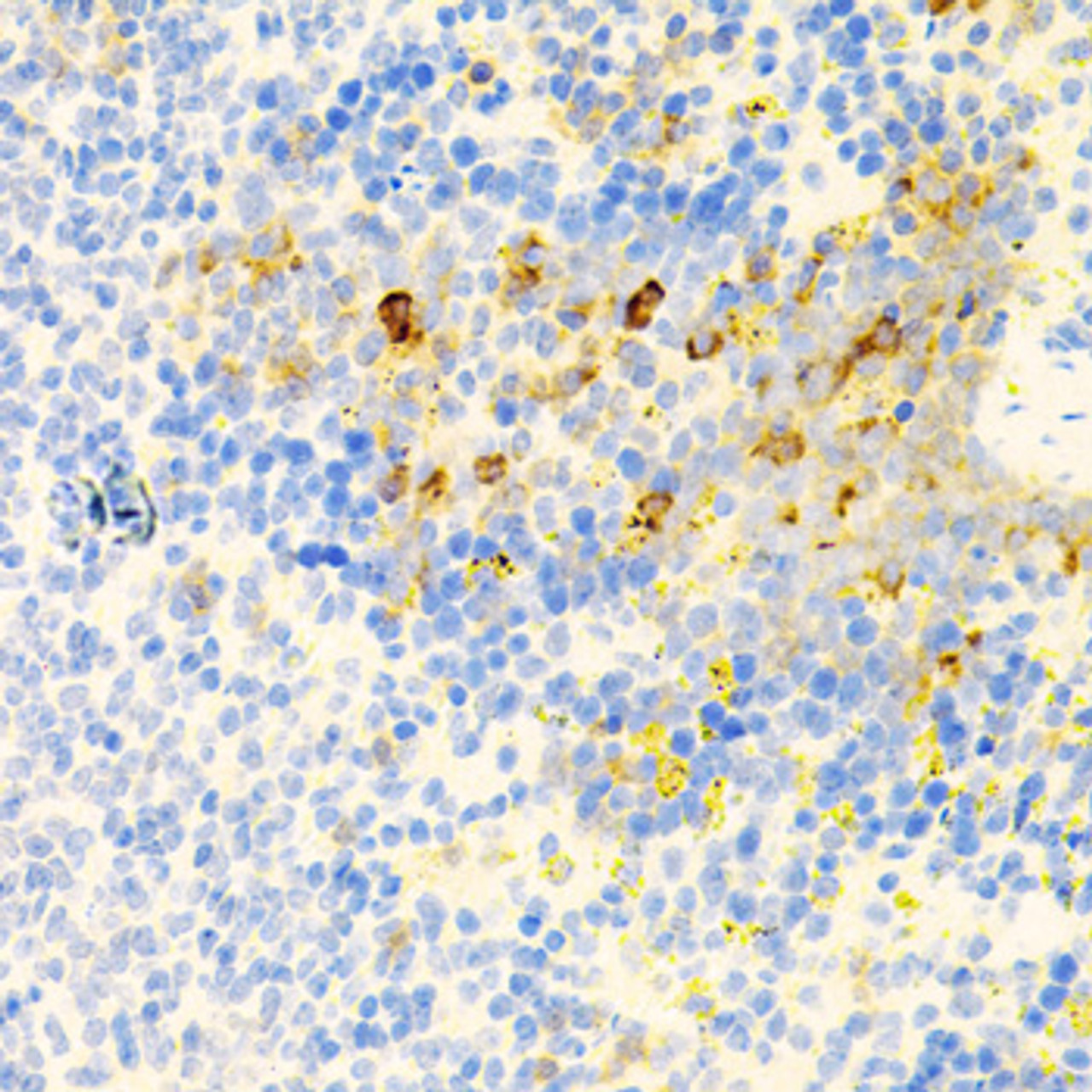 Immunohistochemistry of paraffin-embedded mouse spleen using PROK2 antibody (22-421) at dilution of 1:100 (40x lens) .