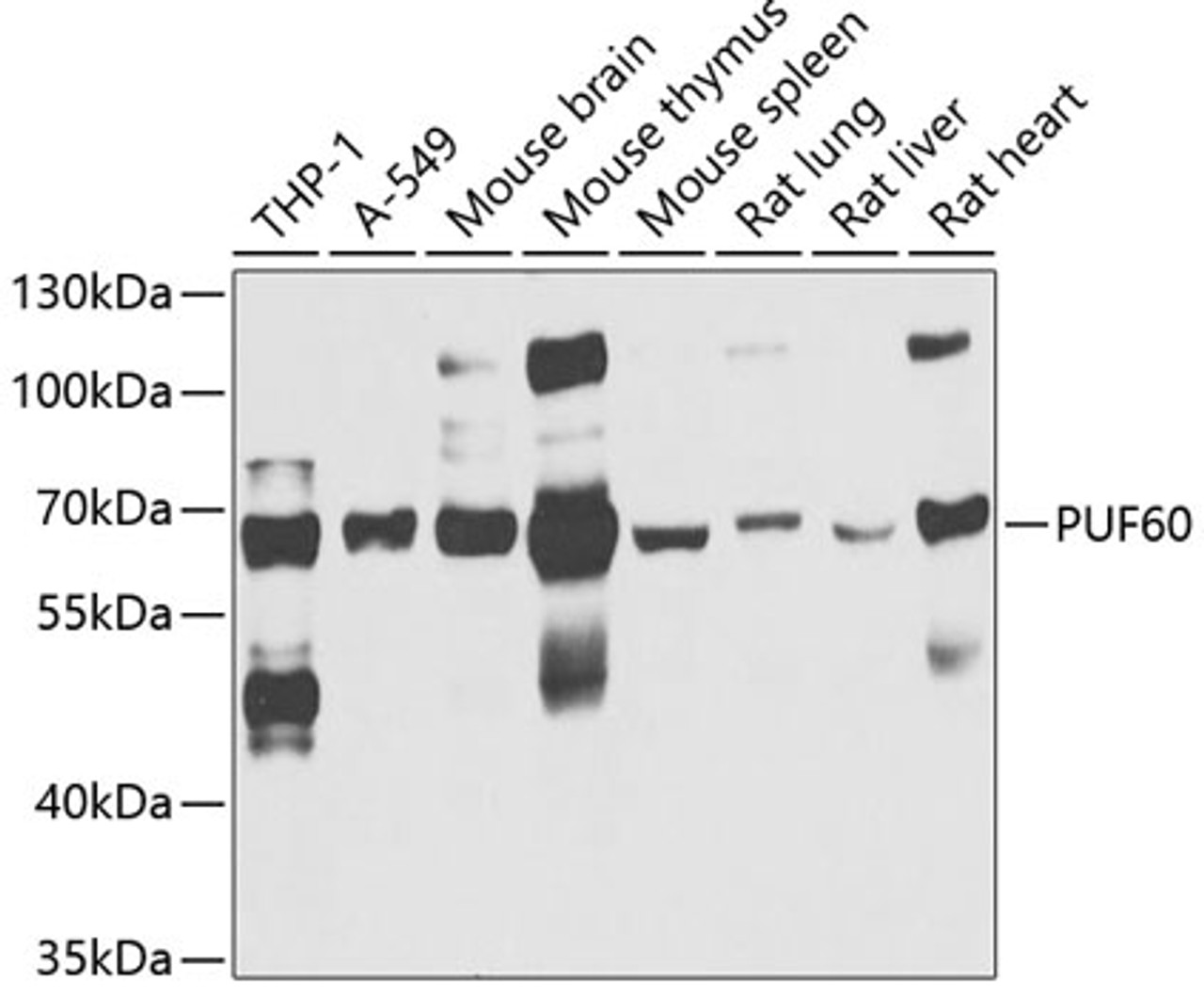 Western blot analysis of extracts of various cell lines, using PUF60 antibody (22-425) at 1:1000 dilution.<br/>Secondary antibody: HRP Goat Anti-Rabbit IgG (H+L) at 1:10000 dilution.<br/>Lysates/proteins: 25ug per lane.<br/>Blocking buffer: 3% nonfat dry milk in TBST.<br/>Detection: ECL Basic Kit.<br/>Exposure time: 30s.